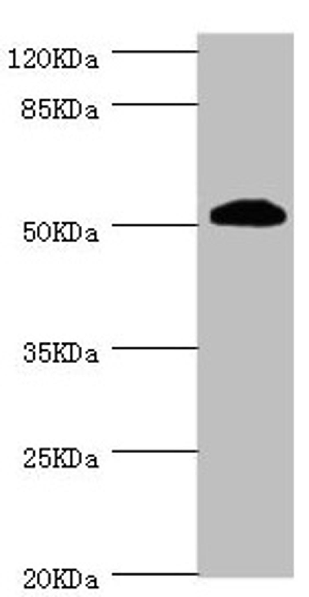 Western blot. All lanes: ZC3HC1 antibody at 1.08µg/ml + Hela whole cell lysate. Secondary. Goat polyclonal to rabbit IgG at 1/10000 dilution. Predicted band size: 56, 54, 48 kDa. Observed band size: 54 kDa