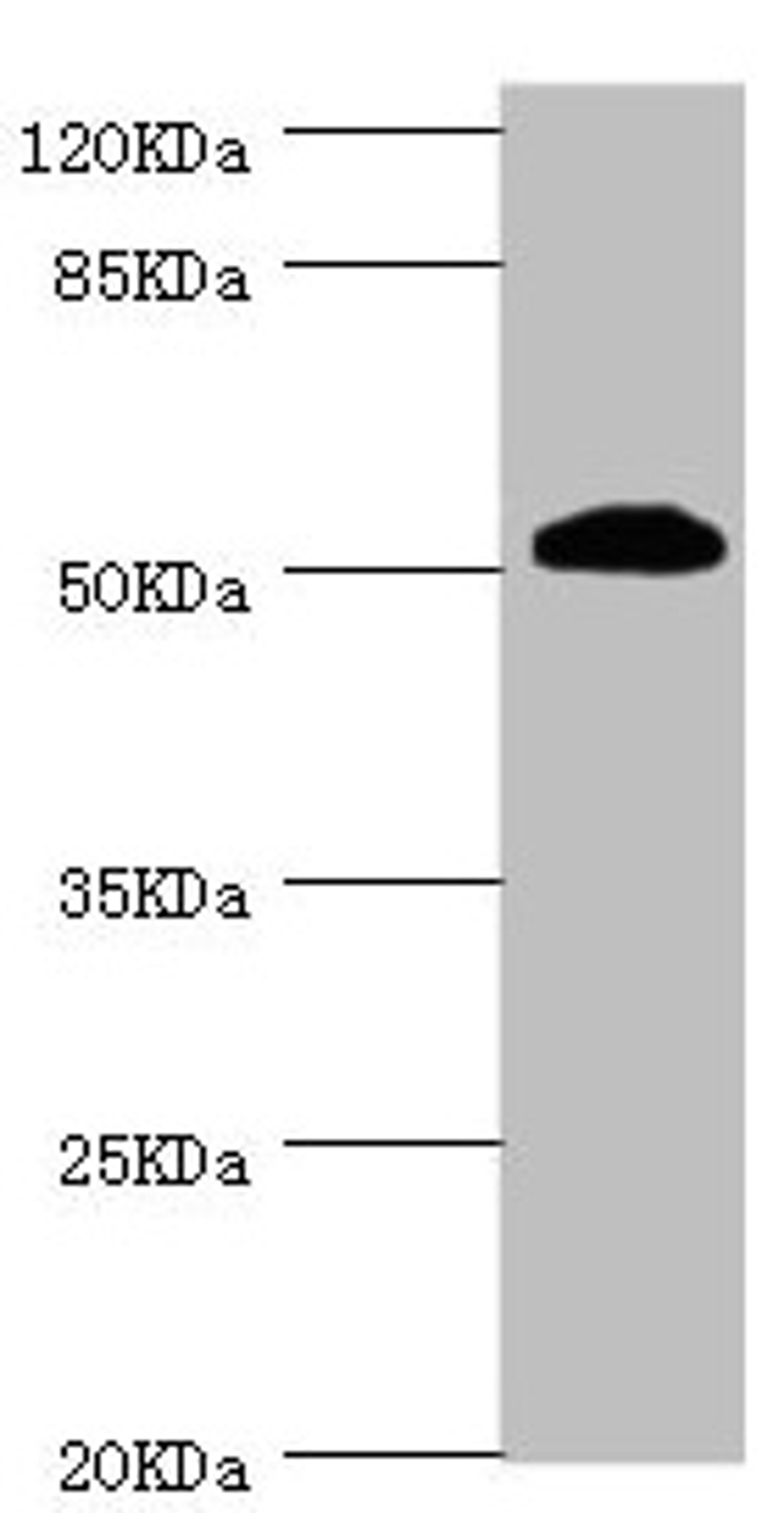 Western blot. All lanes: ZC3HC1 antibody at 1.08µg/ml + Hela whole cell lysate. Secondary. Goat polyclonal to rabbit IgG at 1/10000 dilution. Predicted band size: 56, 54, 48 kDa. Observed band size: 54 kDa