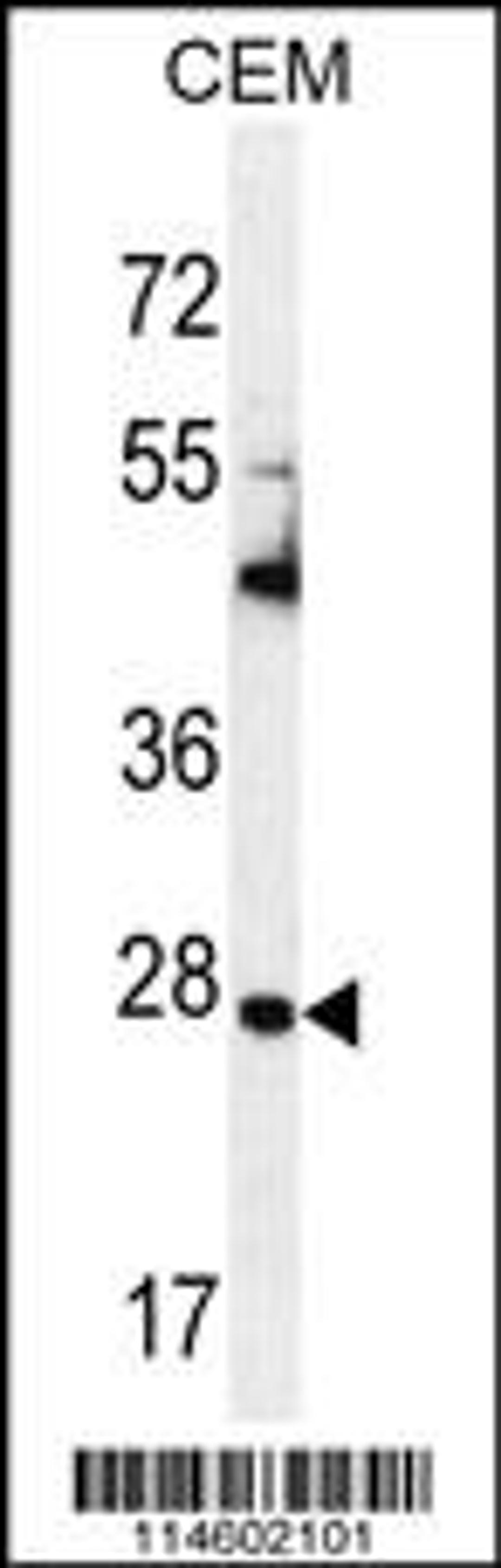 Western blot analysis in CEM cell line lysates (35ug/lane).