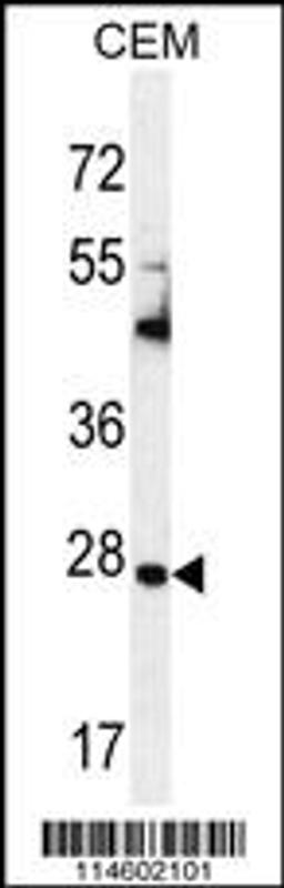 Western blot analysis in CEM cell line lysates (35ug/lane).