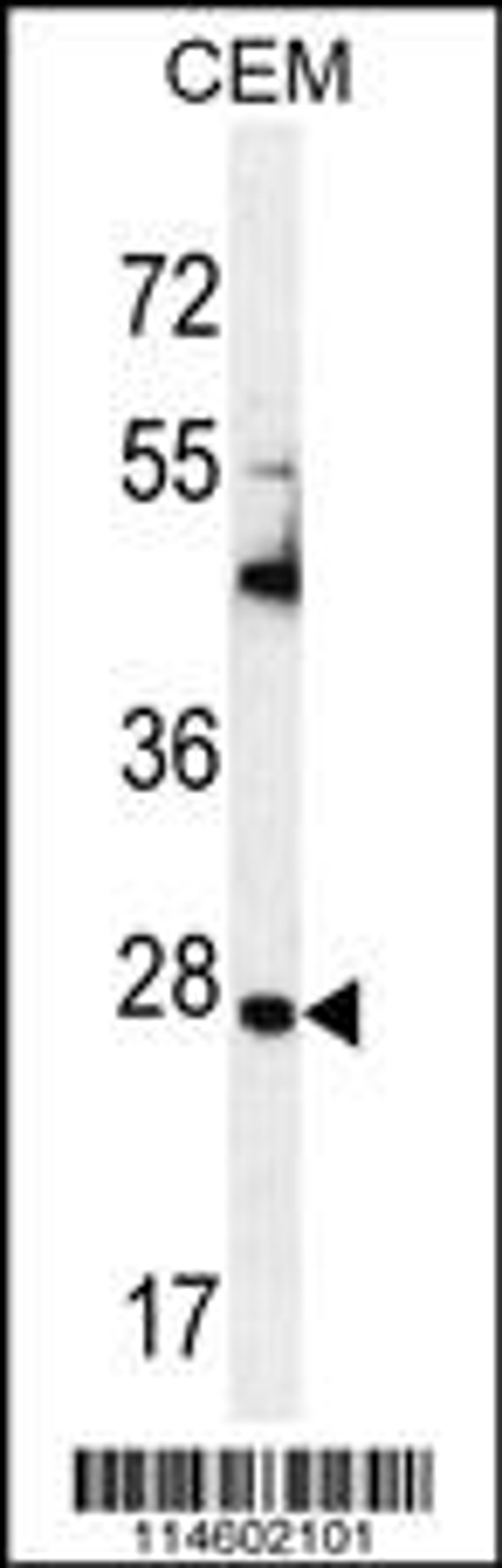 Western blot analysis in CEM cell line lysates (35ug/lane).