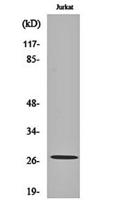 Western blot analysis of Jurkat cell lysates using MaxiK beta 2 antibody