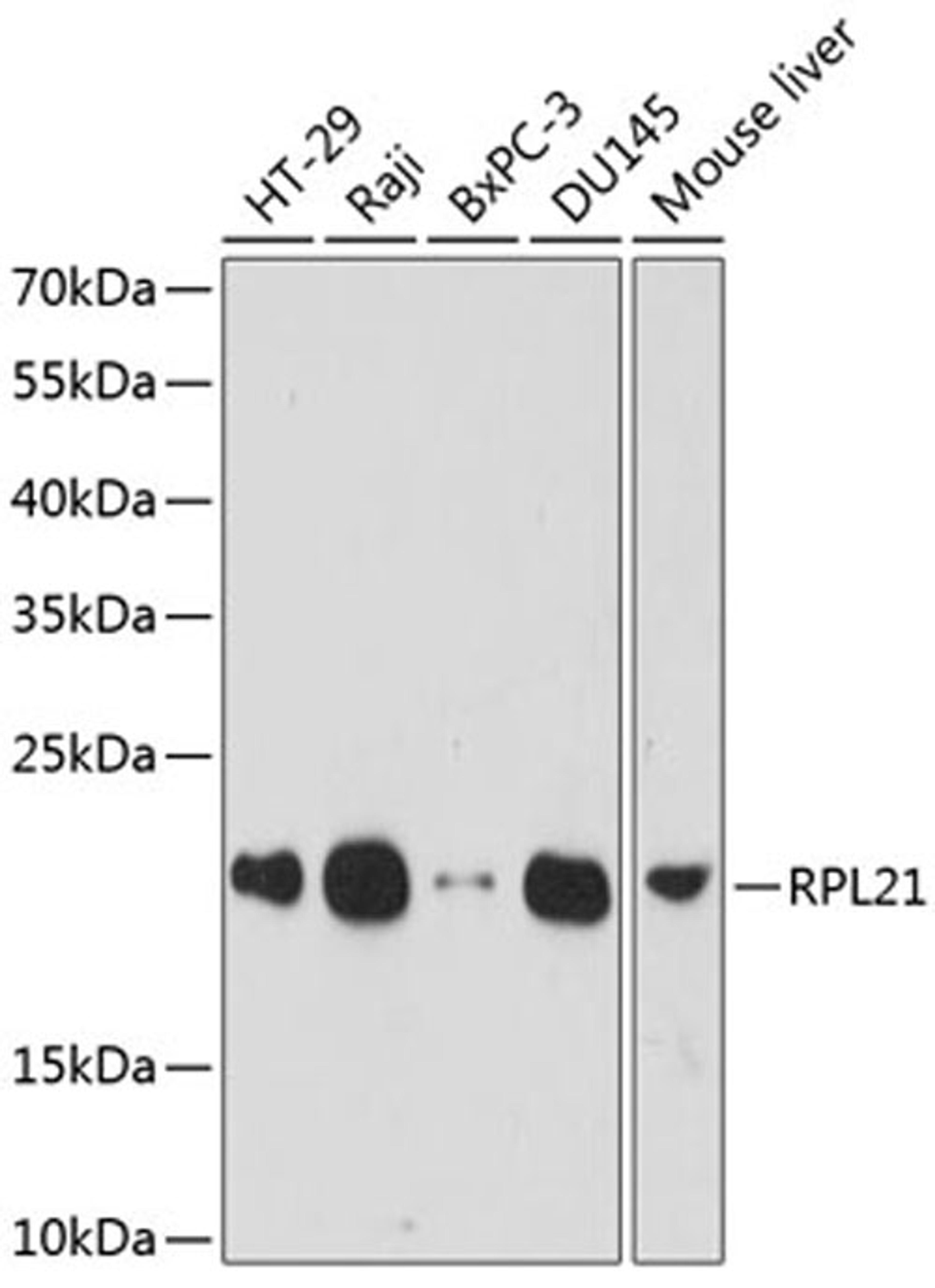 Western blot - RPL21 antibody (A14254)