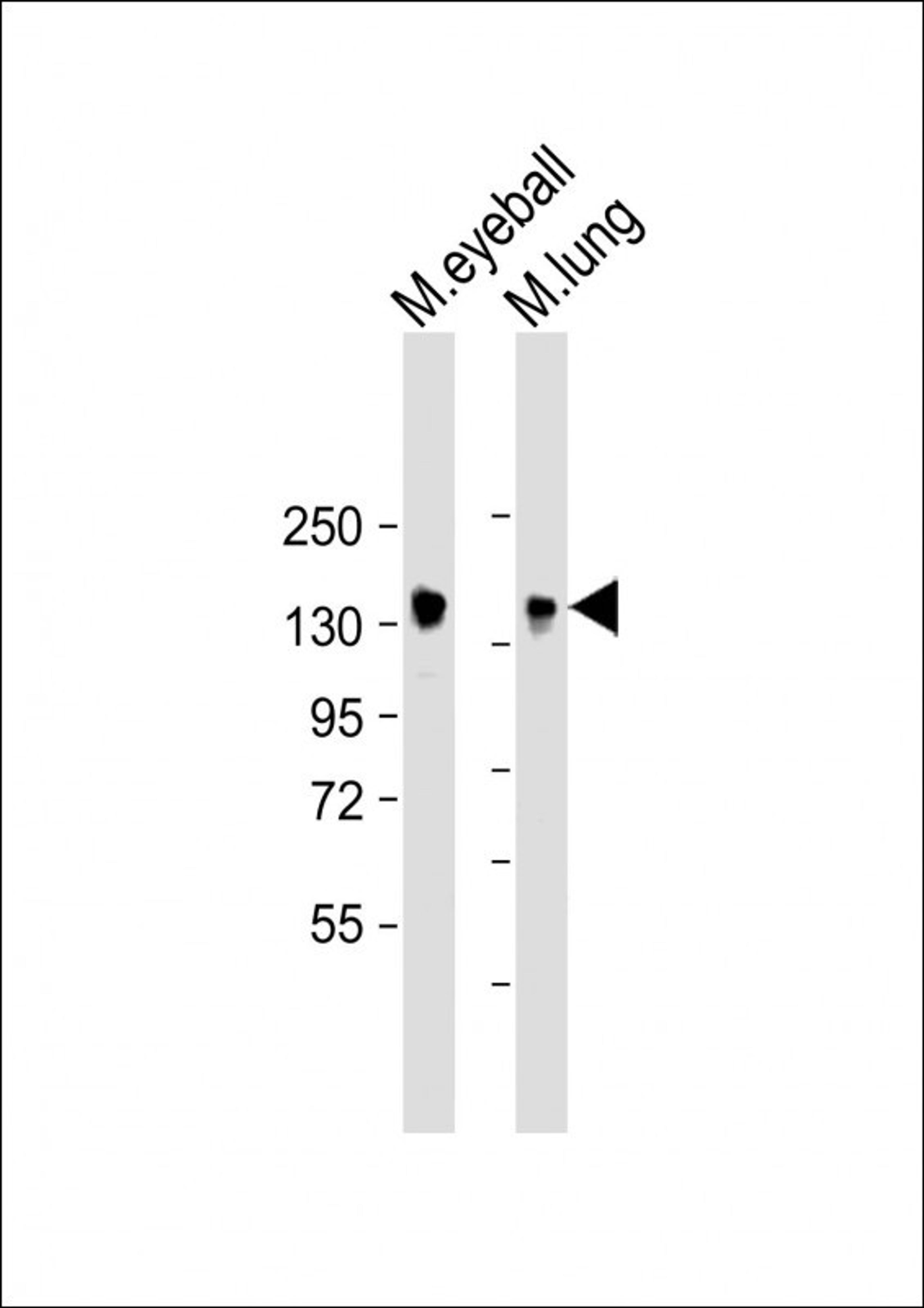 Western Blot at 1:2000 dilution Lane 1: mouse eyeball lysate Lane 2: mouse lung lysate Lysates/proteins at 20 ug per lane.