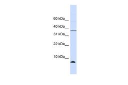 Antibody used in WB on Human Brain at 0.2-1 ug/ml.