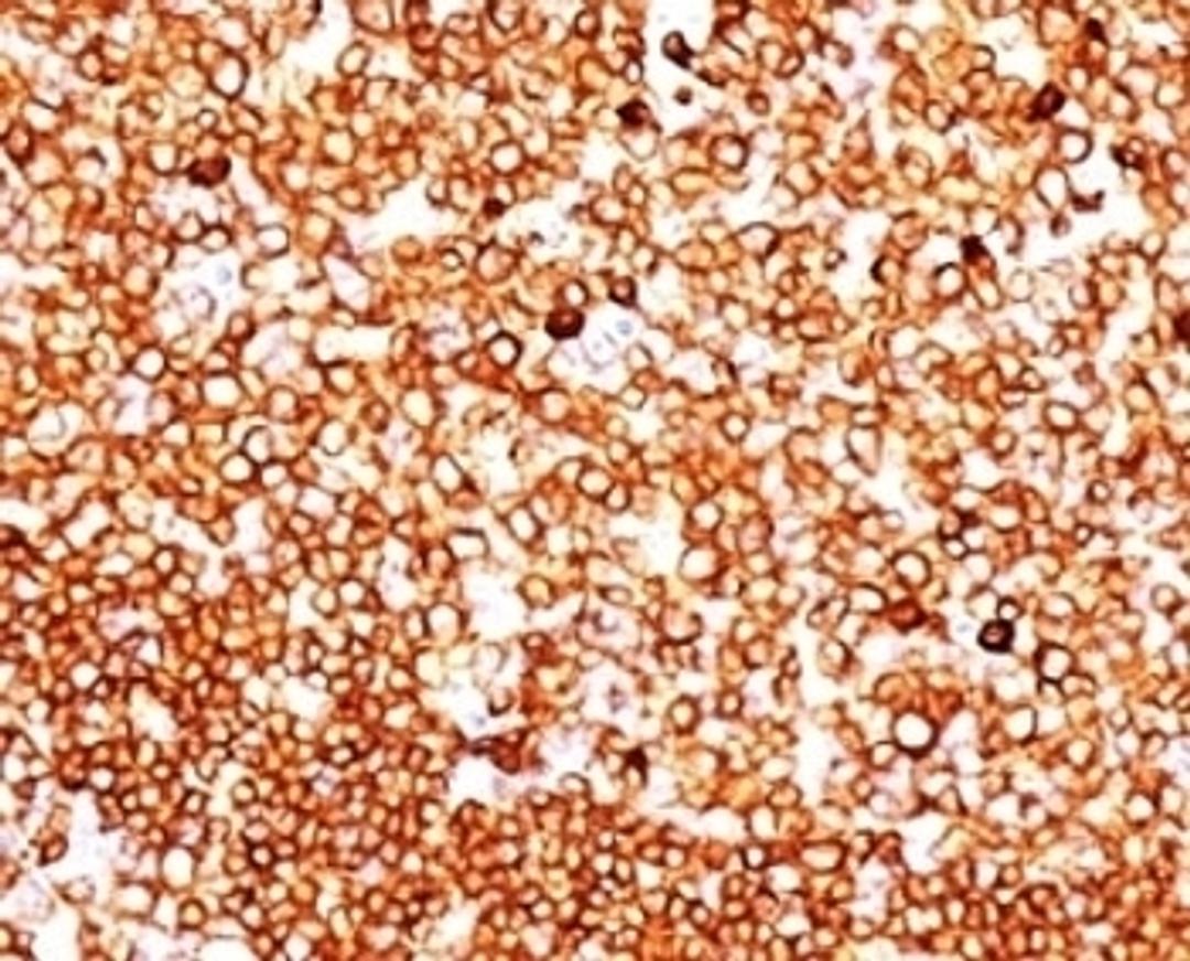 Formalin-fixed, paraffin-embedded human tonsil stained with CD79 antibody (SPM549).