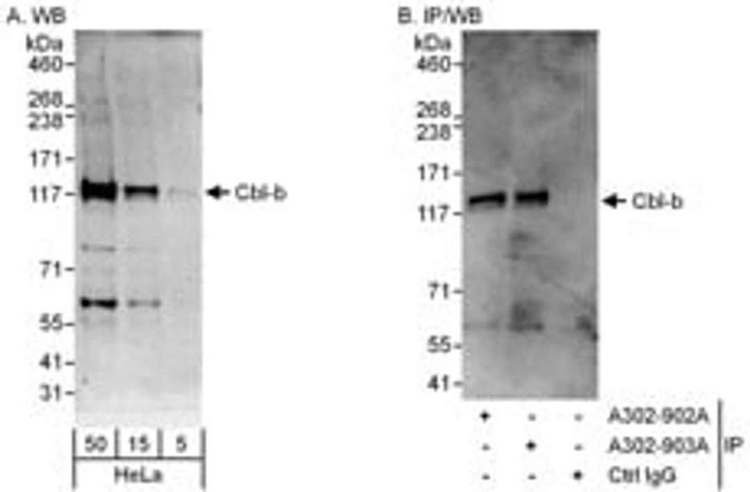 Detection of human Cbl-b by western blot and immunoprecipitation.