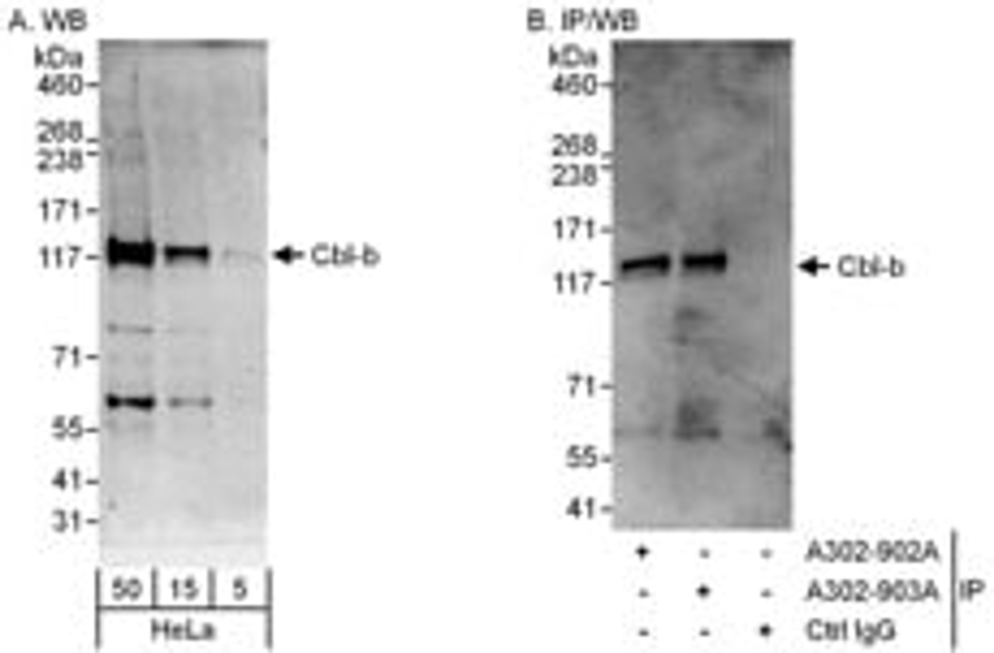 Detection of human Cbl-b by western blot and immunoprecipitation.