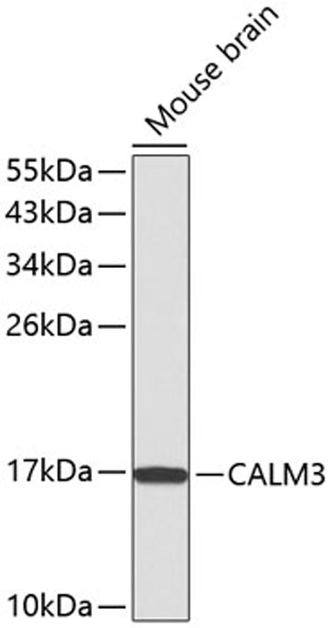 Western blot - CALM3 antibody (A1161)