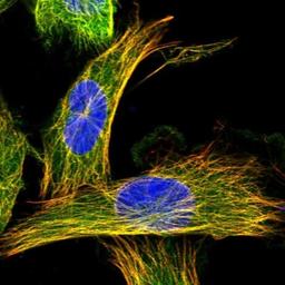 Immunocytochemistry/Immunofluorescence: CCDC40 Antibody [NBP1-82162] - Staining of human cell line U-251MG shows positivity in cytoskeleton (microtubules).