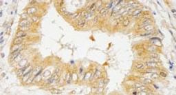 Detection of human GRB10 by immunohistochemistry.