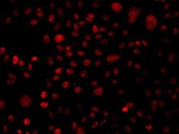 Immunofluorescence analysis of A549 cell using BAF250 antibody