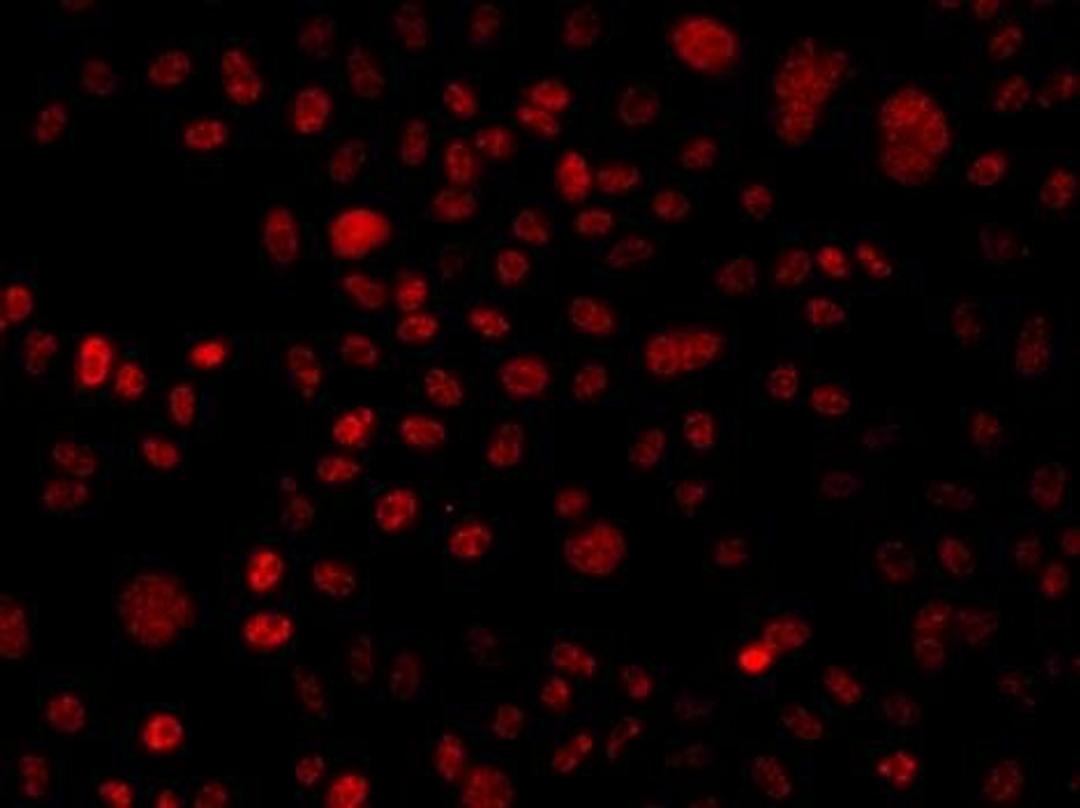 Immunofluorescence analysis of A549 cell using BAF250 antibody
