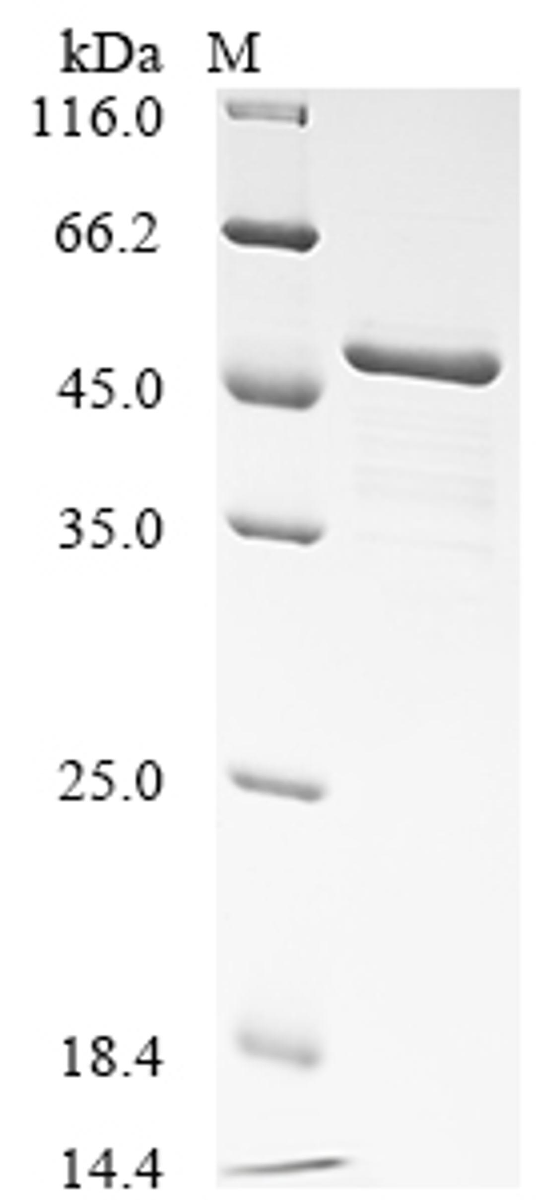 (Tris-Glycine gel) Discontinuous SDS-PAGE (reduced) with 5% enrichment gel and 15% separation gel.