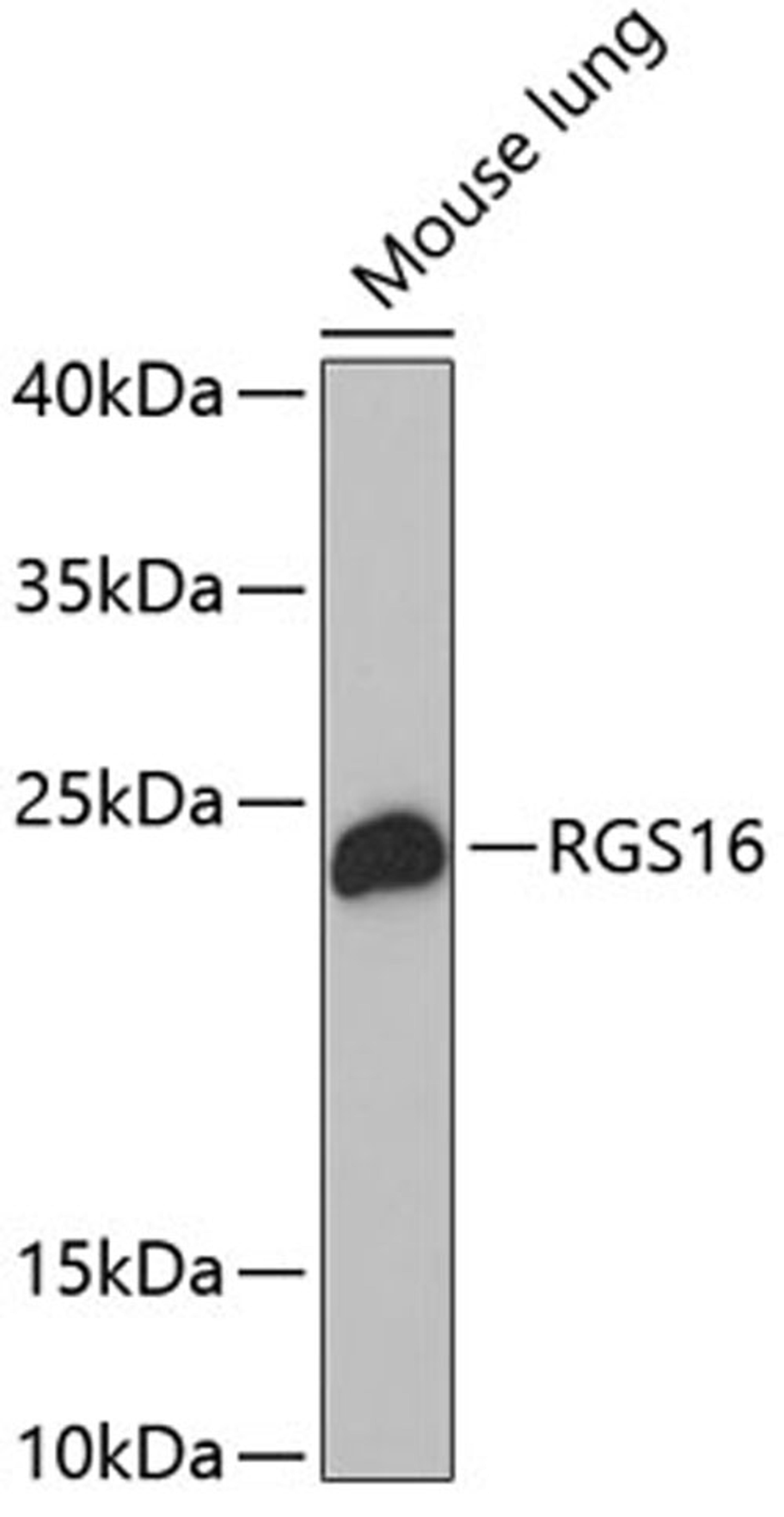 Western blot - RGS16 antibody (A4078)