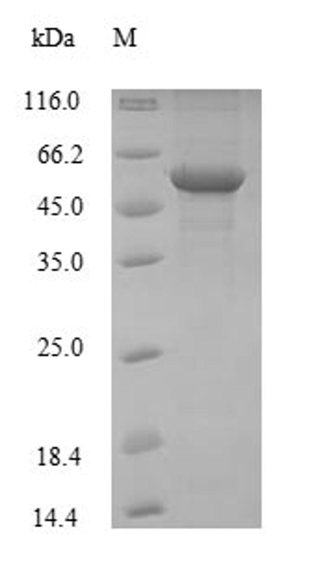 (Tris-Glycine gel) Discontinuous SDS-PAGE (reduced) with 5% enrichment gel and 15% separation gel.