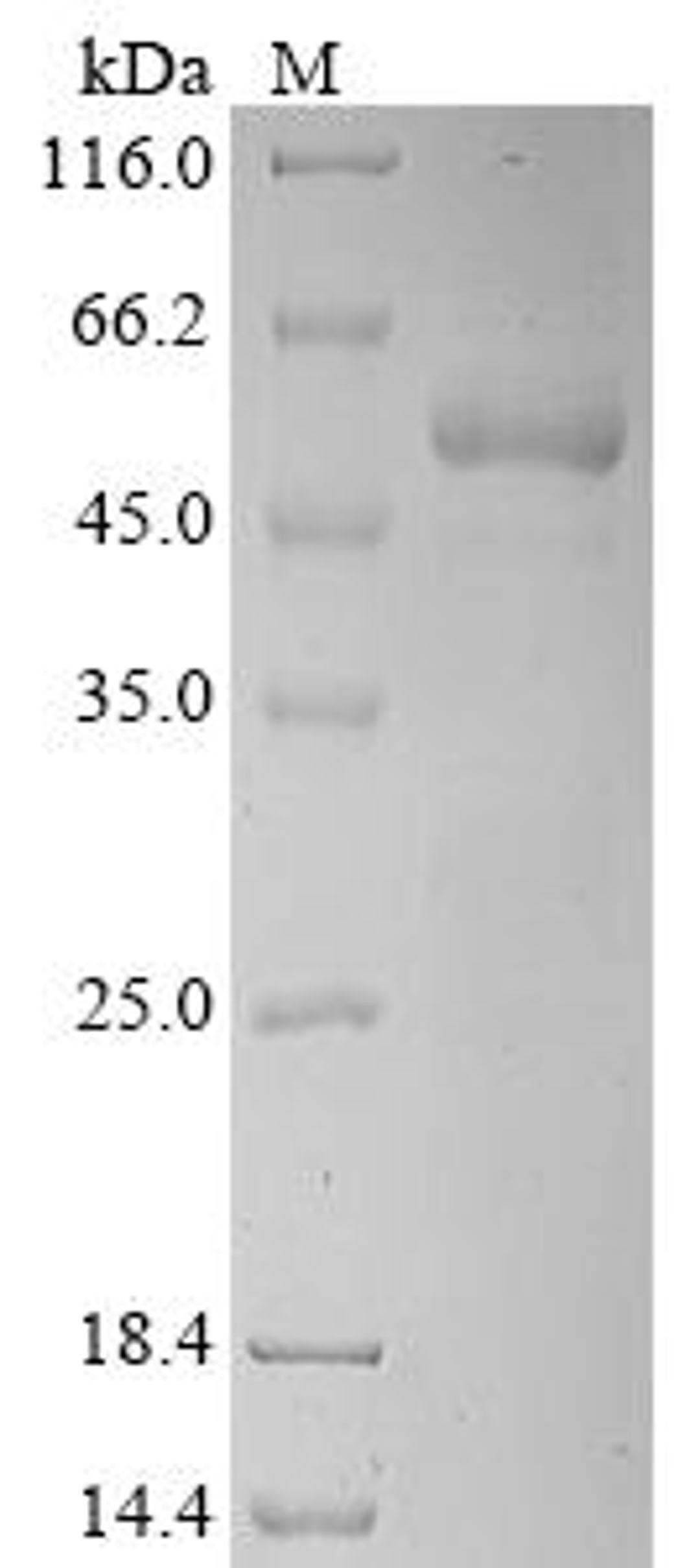 (Tris-Glycine gel) Discontinuous SDS-PAGE (reduced) with 5% enrichment gel and 15% separation gel.