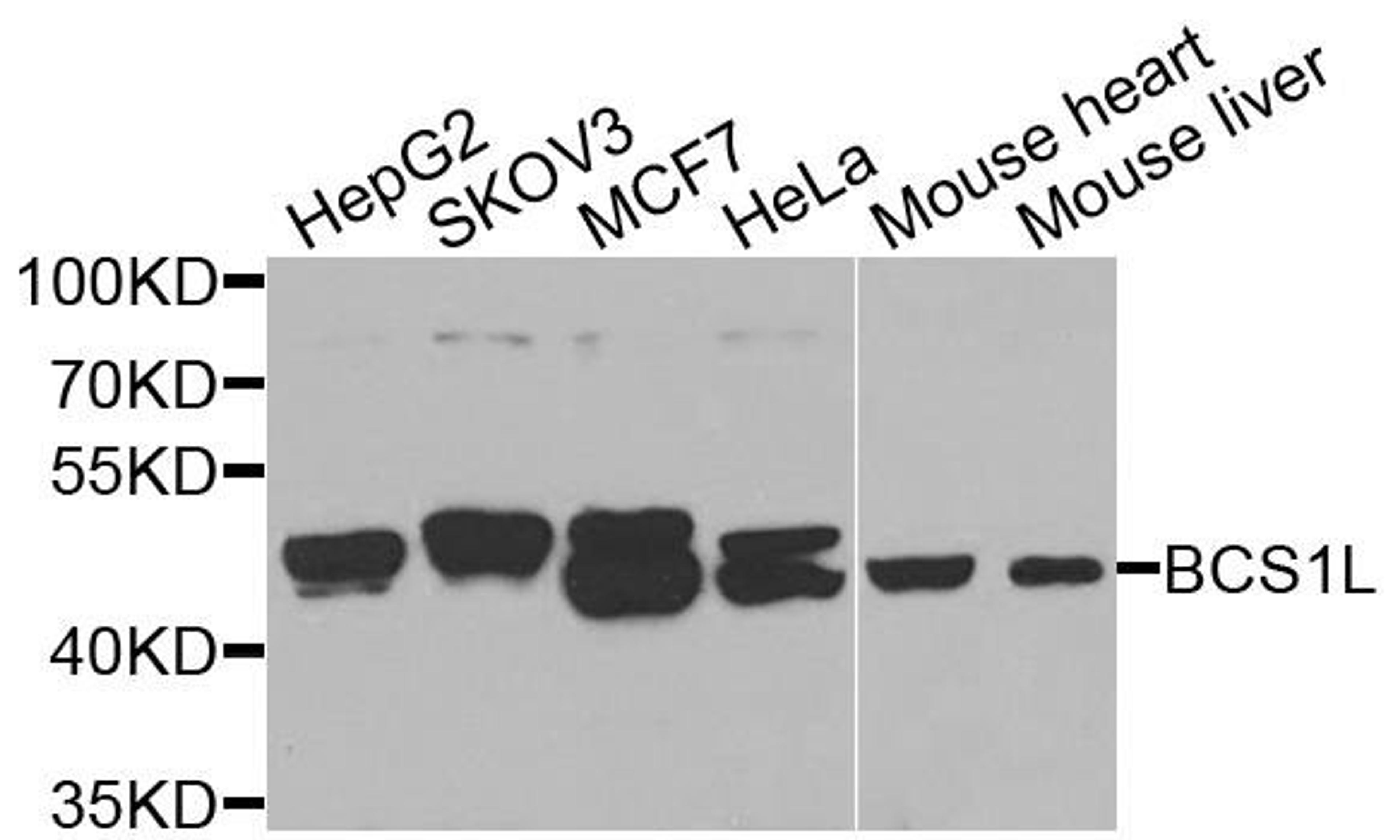 Western blot analysis of extracts of various cell lines using BCS1L antibody