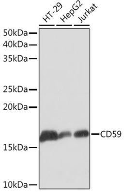 Western blot - CD59 Rabbit mAb (A4090)