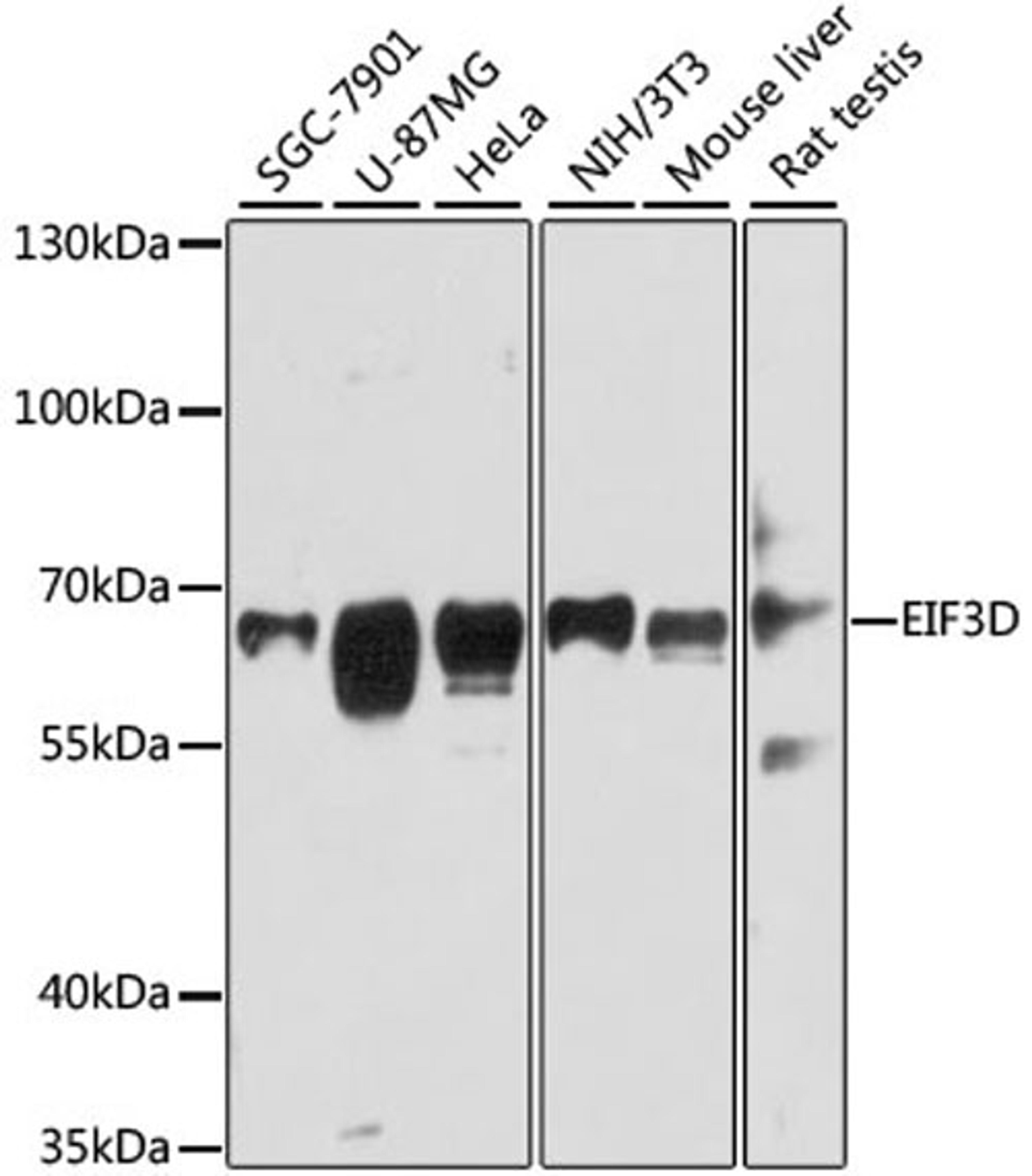 Western blot - EIF3D antibody (A5947)