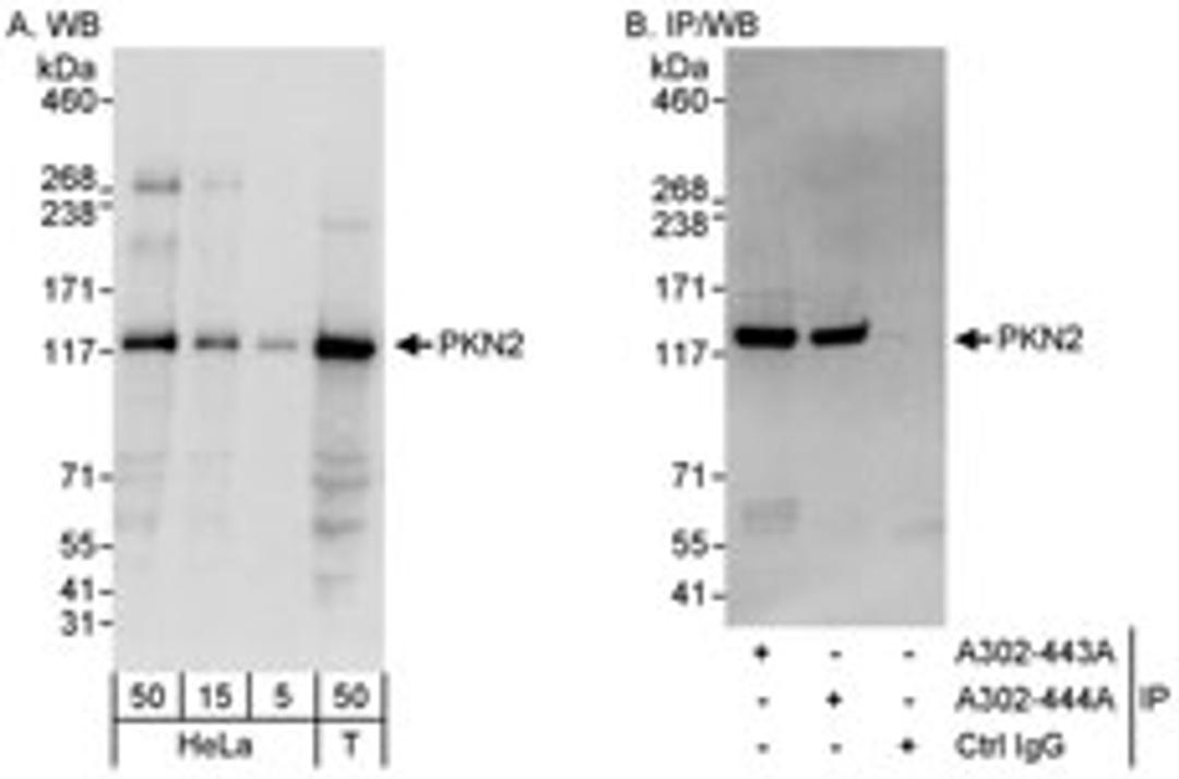 Detection of human PKN2 by western blot and immunoprecipitation.