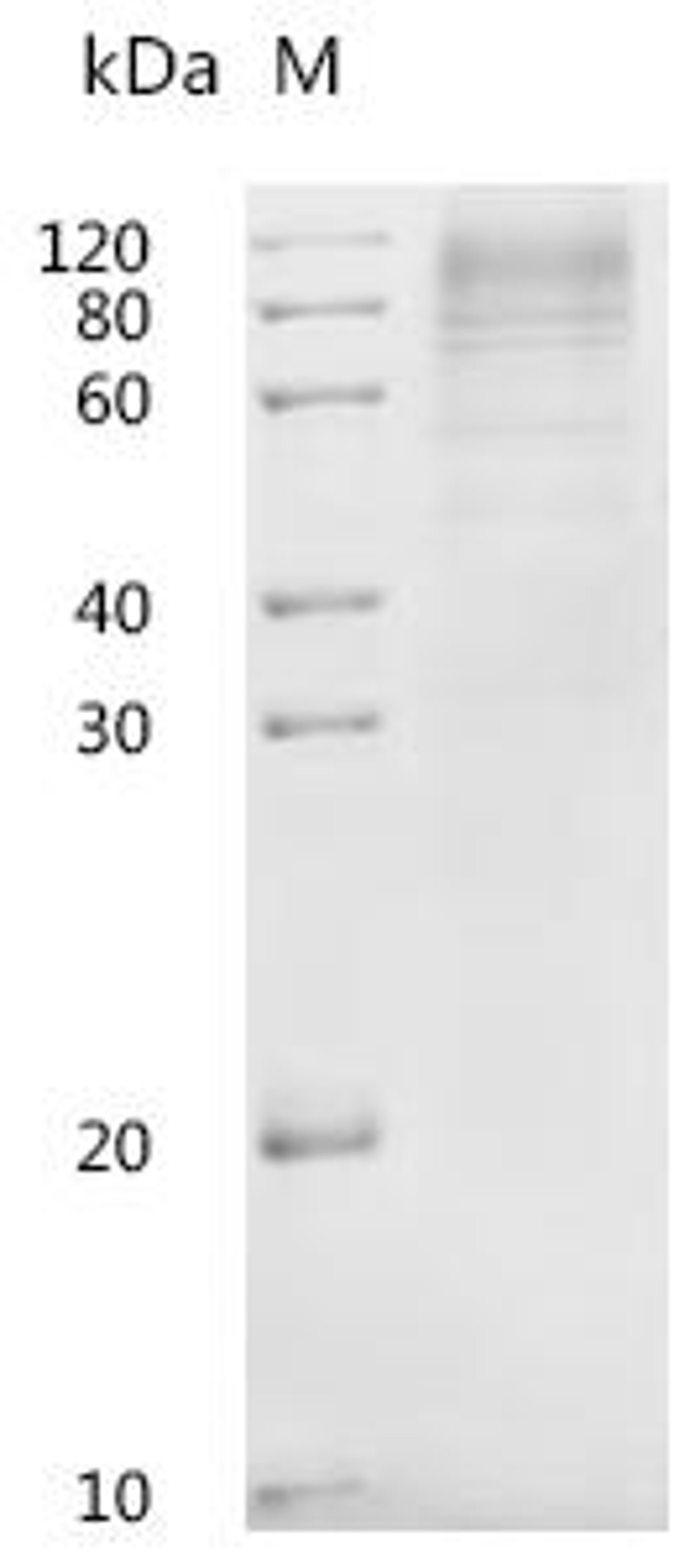 (Tris-Glycine gel) Discontinuous SDS-PAGE (reduced) with 5% enrichment gel and 15% separation gel.