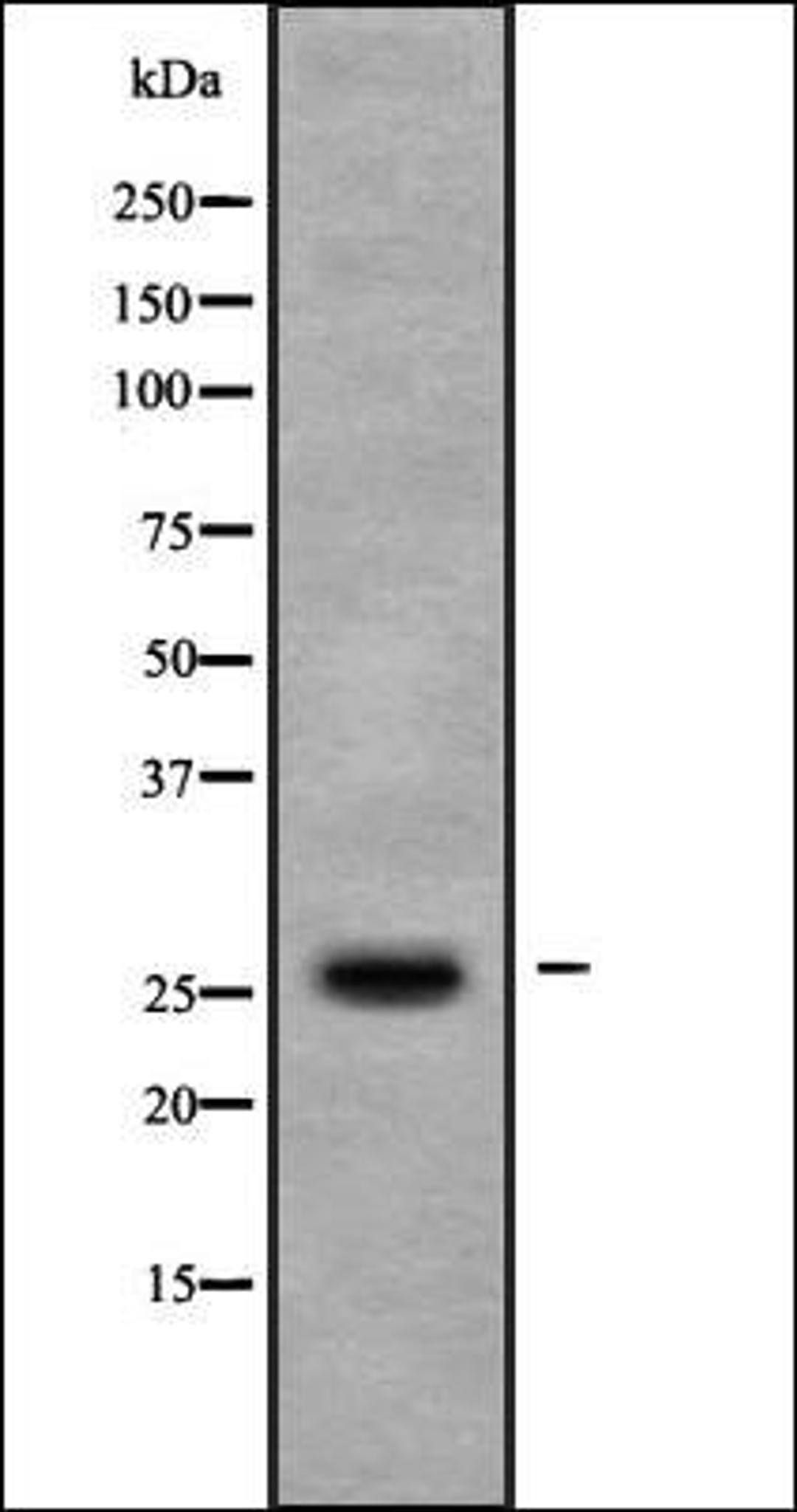 Western blot analysis of COLO205 whole cell lysates using TIGA1 antibody