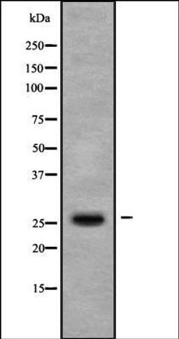 Western blot analysis of COLO205 whole cell lysates using TIGA1 antibody