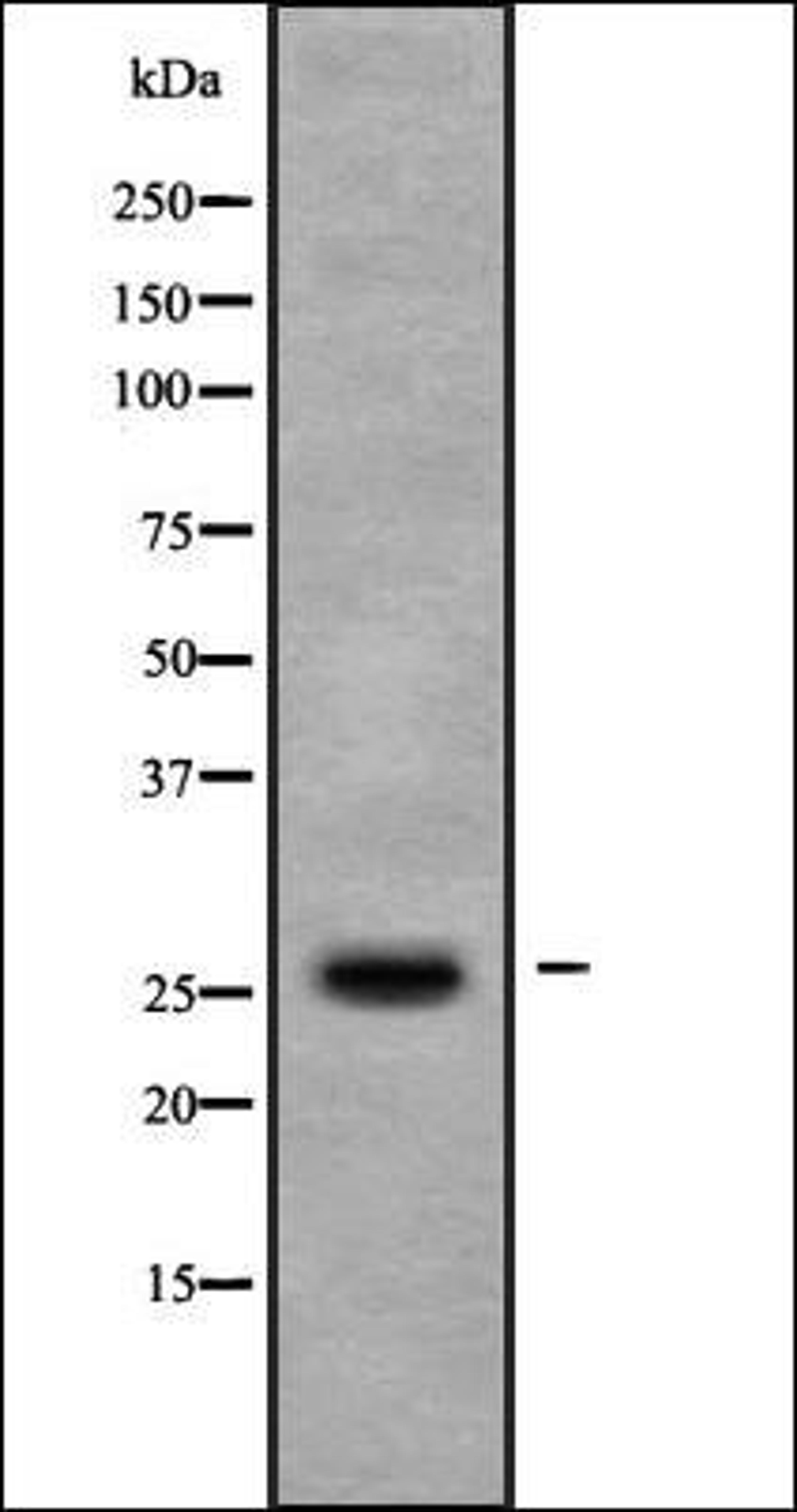 Western blot analysis of COLO205 whole cell lysates using TIGA1 antibody