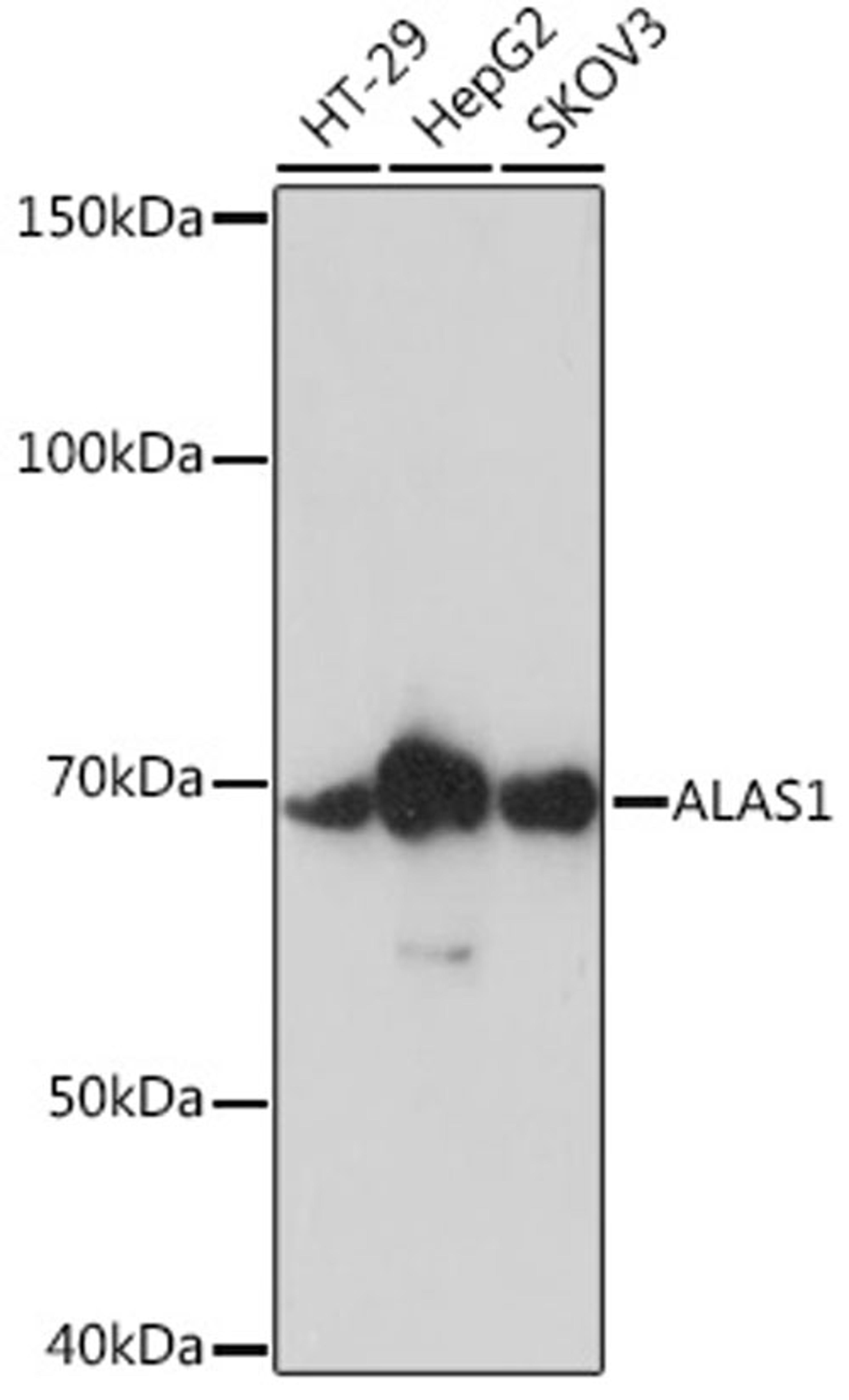 Western blot - ALAS1 Rabbit mAb (A4817)