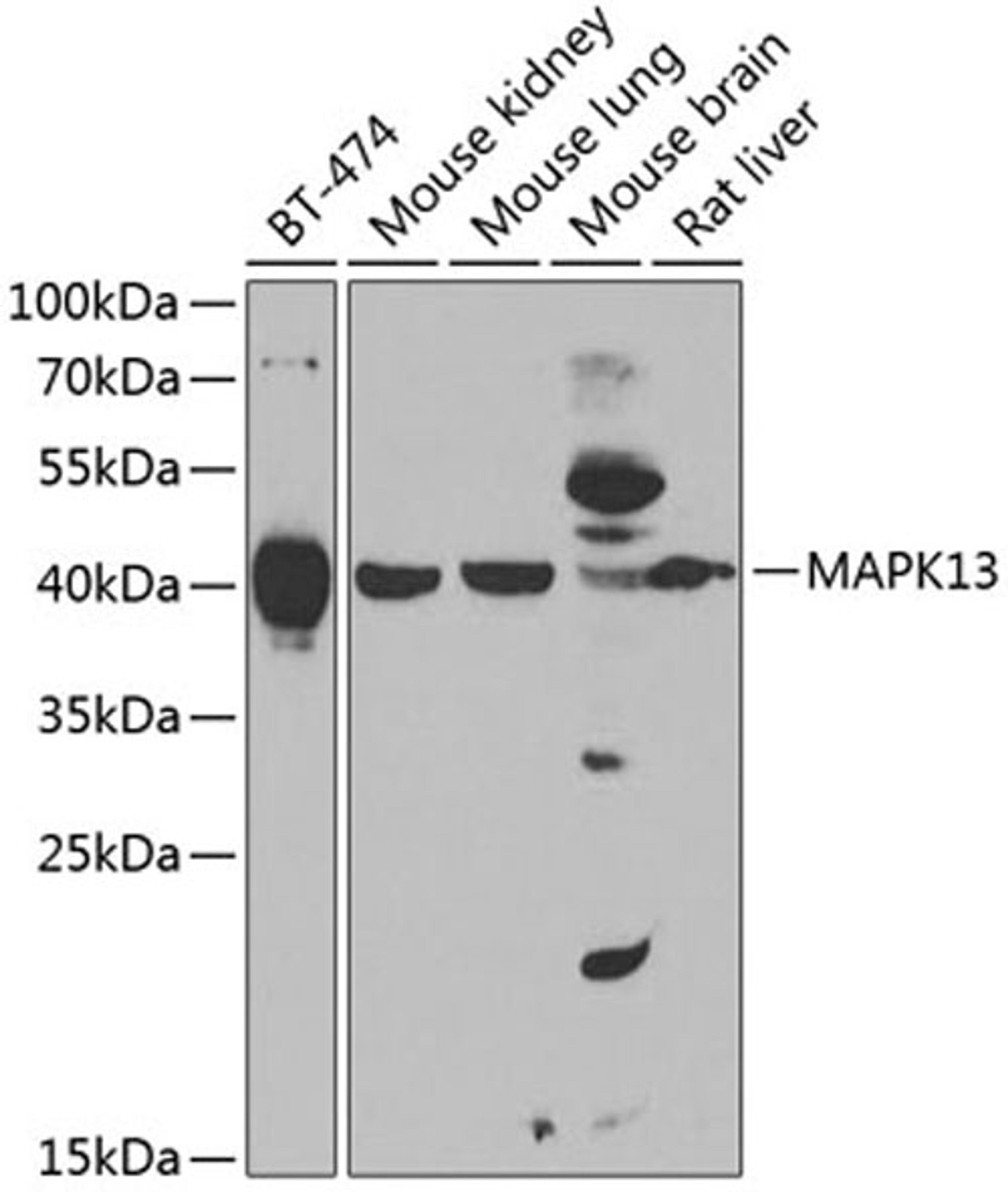 Western blot - MAPK13 antibody (A7496)