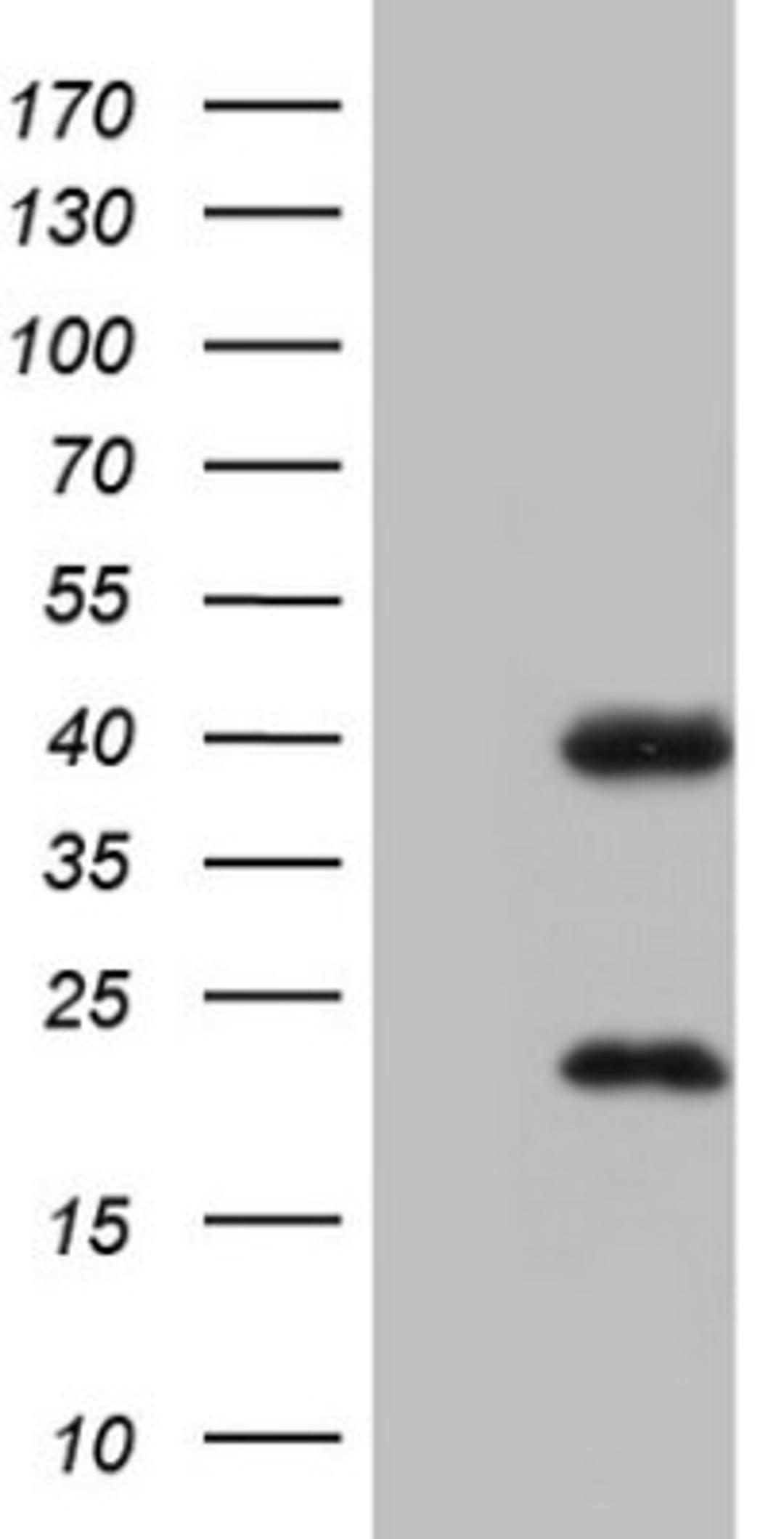 Western Blot: CAR/NR1I3 Antibody (1C6) [NBP2-46226] - Analysis of HEK293T cells were transfected with the pCMV6-ENTRY control (Left lane) or pCMV6-ENTRY NR1I3.