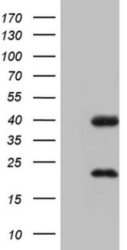 Western Blot: CAR/NR1I3 Antibody (1C6) [NBP2-46226] - Analysis of HEK293T cells were transfected with the pCMV6-ENTRY control (Left lane) or pCMV6-ENTRY NR1I3.