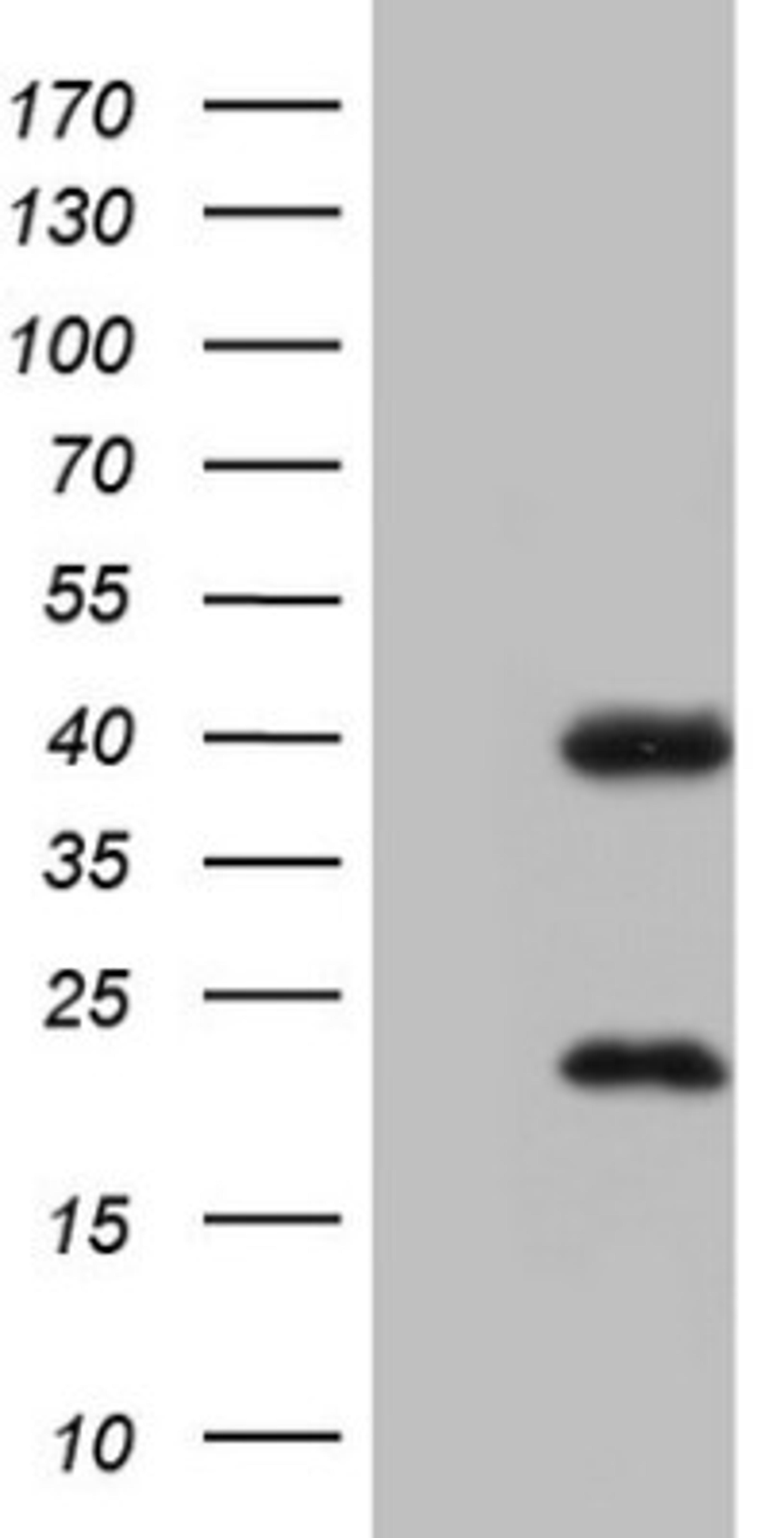 Western Blot: CAR/NR1I3 Antibody (1C6) [NBP2-46226] - Analysis of HEK293T cells were transfected with the pCMV6-ENTRY control (Left lane) or pCMV6-ENTRY NR1I3.