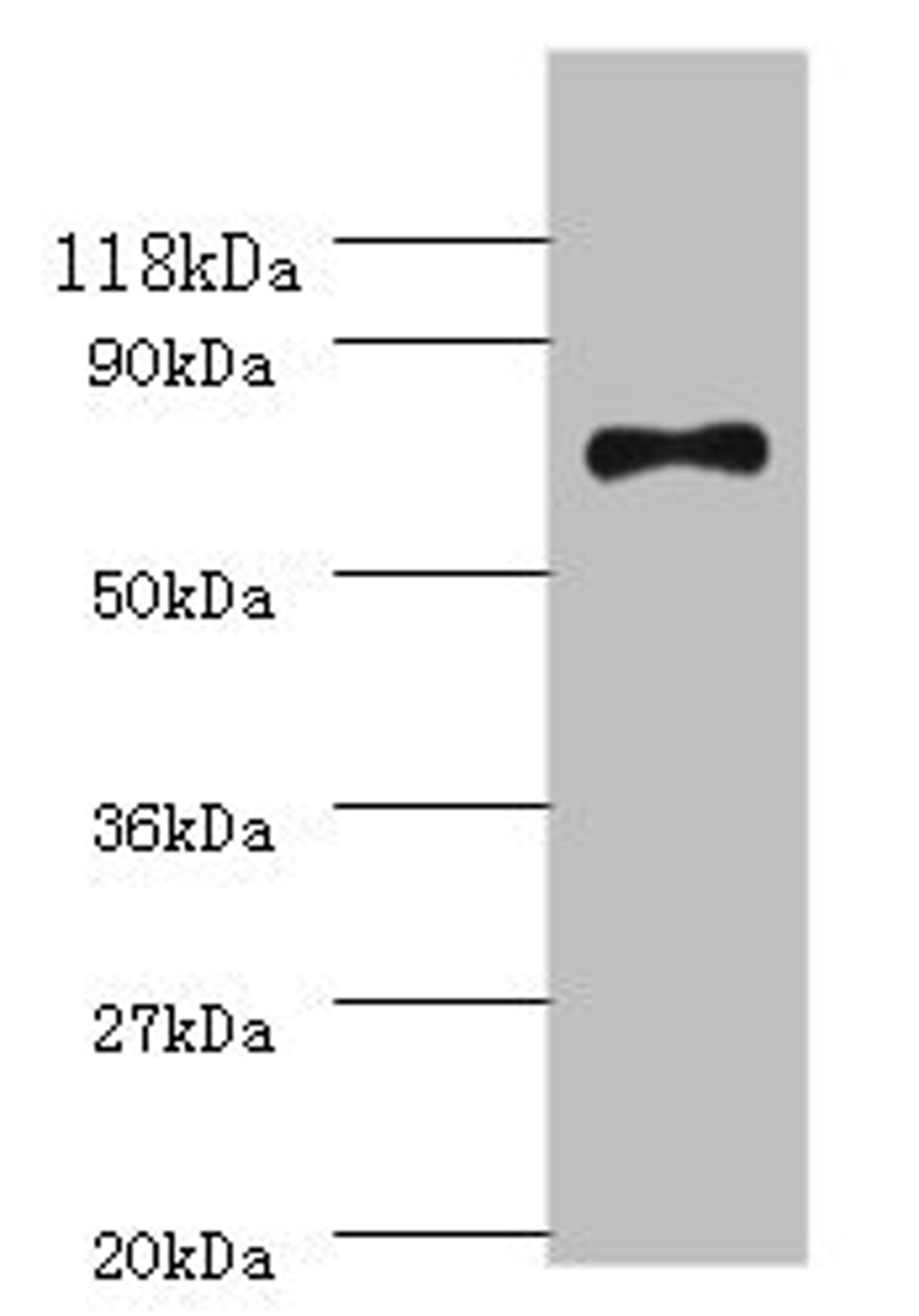 Western blot. All lanes: ATP-dependent DNA helicase RecQ antibody at 2ug/ml + DH5a whole cell lysate. Secondary. Goat polyclonal to rabbit IgG at 1/10000 dilution. Predicted band size: 68 kDa. Observed band size: 68 kDa.