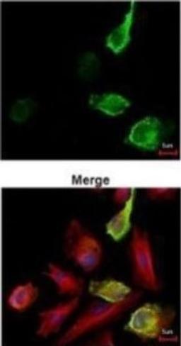 Immunocytochemistry/Immunofluorescence: Myc Epitope Tag Antibody [NBP2-43691] - Analysis of paraformaldehyde-fixed Myc tag transfected HeLa, using Myc tag antibody (green) at 1:3000 dilution. Alpha-tubulin filaments were labeled (red) at 1:2500.