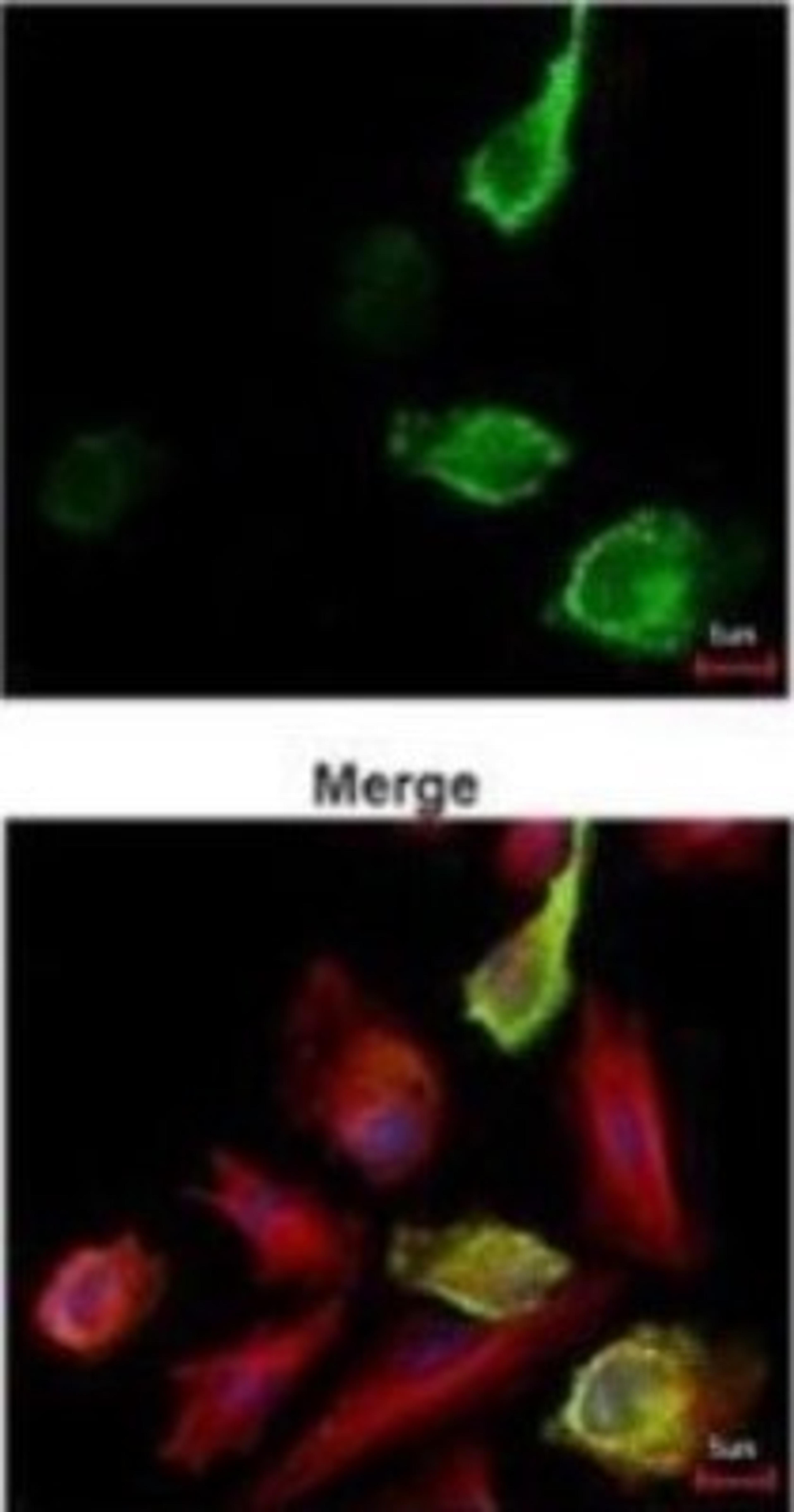 Immunocytochemistry/Immunofluorescence: Myc Epitope Tag Antibody [NBP2-43691] - Analysis of paraformaldehyde-fixed Myc tag transfected HeLa, using Myc tag antibody (green) at 1:3000 dilution. Alpha-tubulin filaments were labeled (red) at 1:2500.