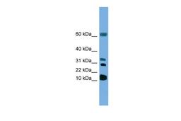 Antibody used in WB on Human HepG2 at 1 ug/ml.