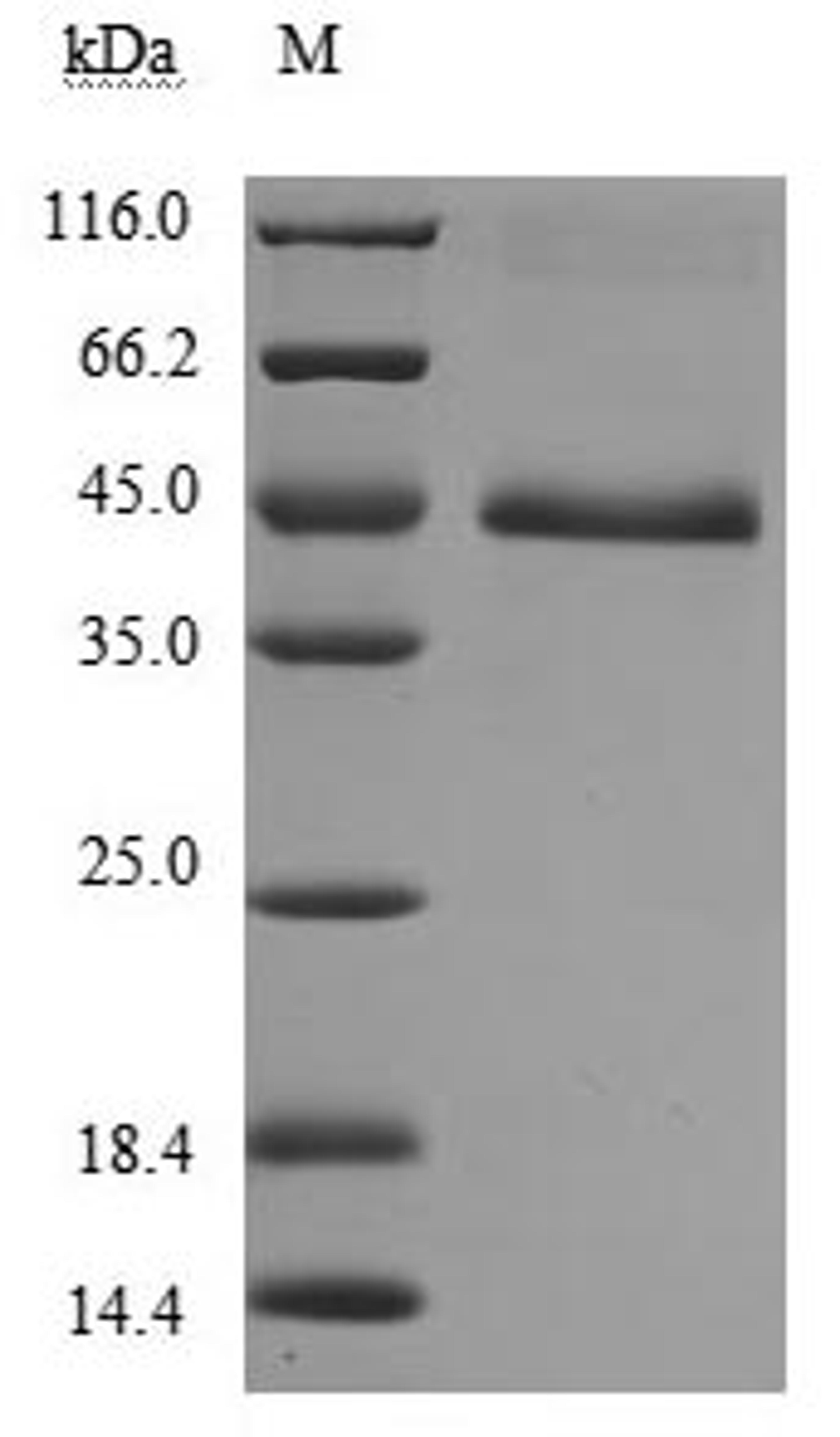 (Tris-Glycine gel) Discontinuous SDS-PAGE (reduced) with 5% enrichment gel and 15% separation gel.