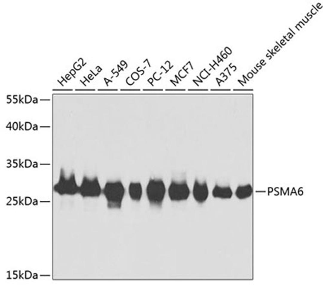 Western blot - PSMA6 antibody (A2188)