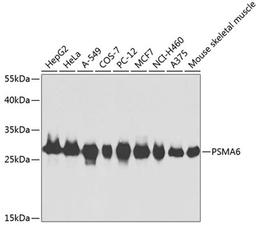 Western blot - PSMA6 antibody (A2188)