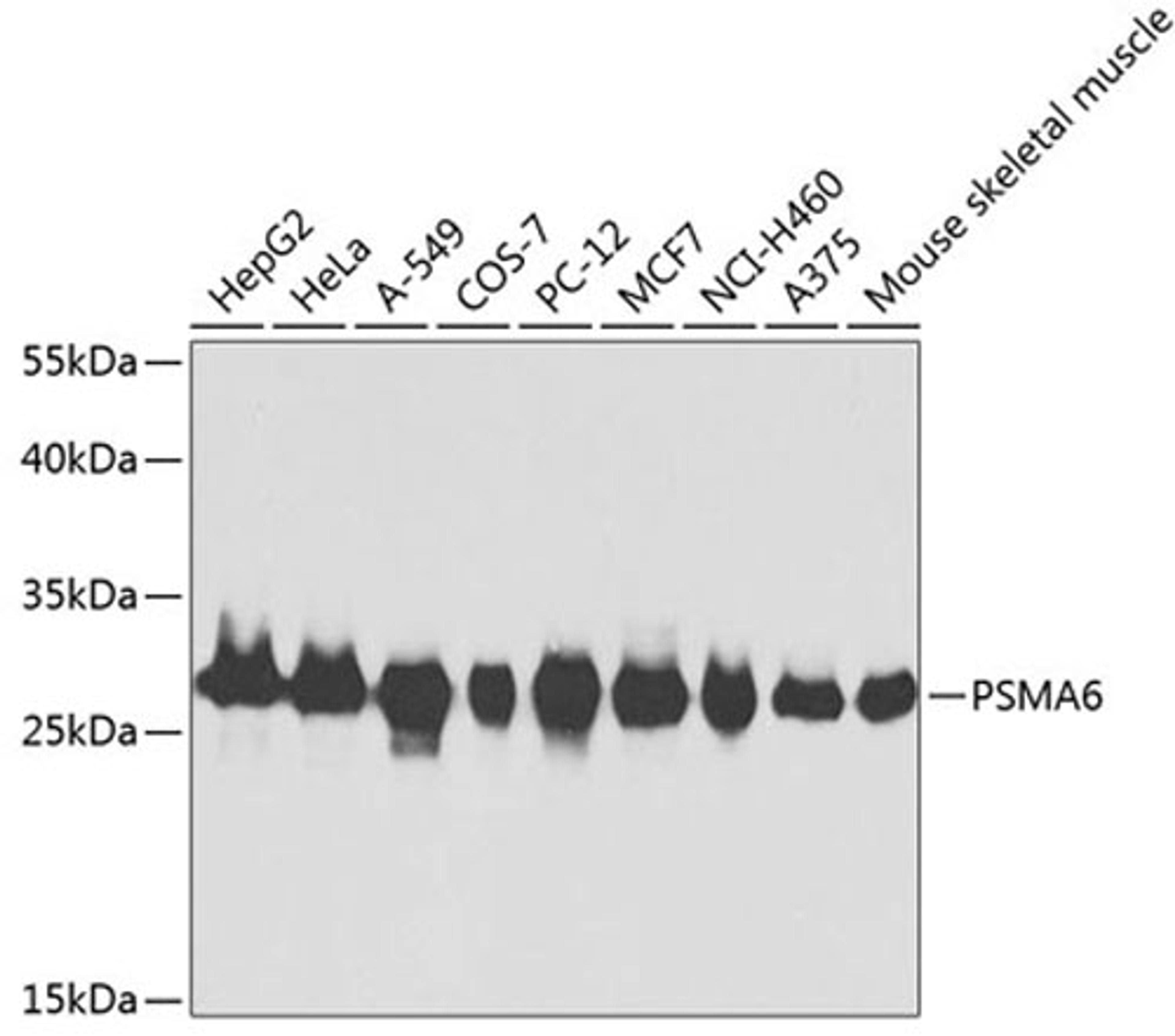 Western blot - PSMA6 antibody (A2188)