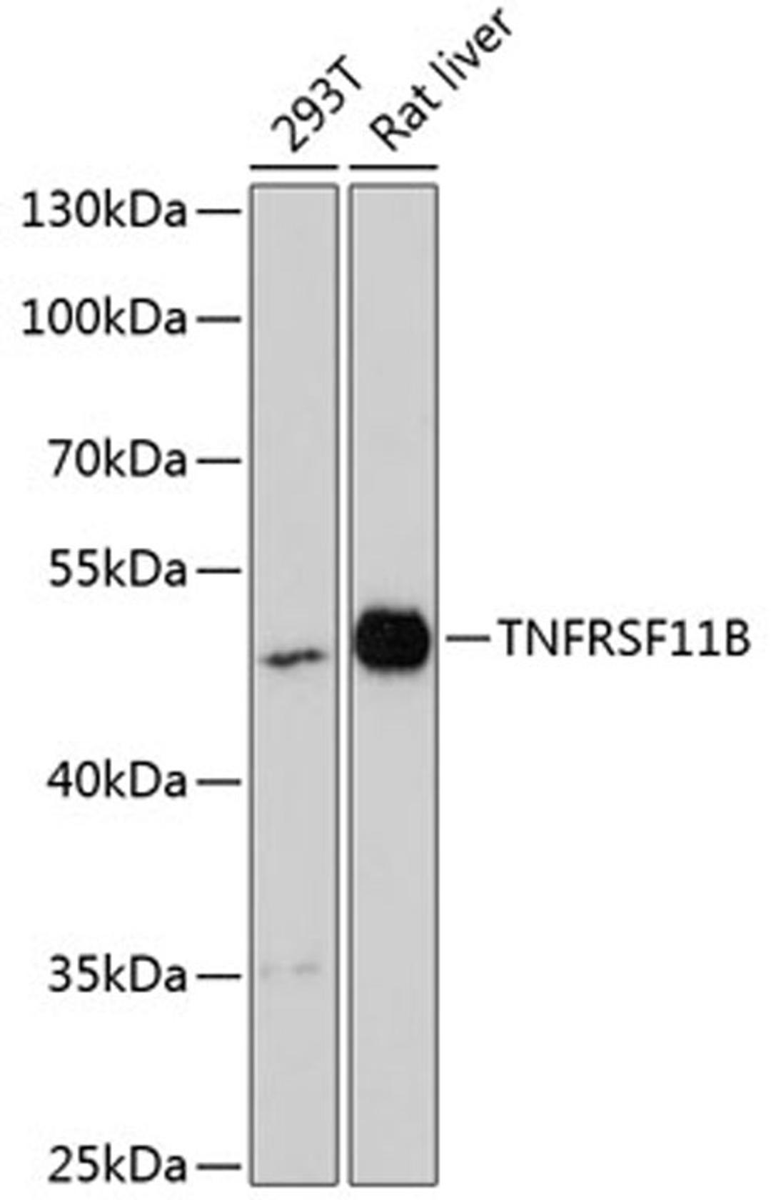 Western blot - TNFRSF11B antibody (A13250)