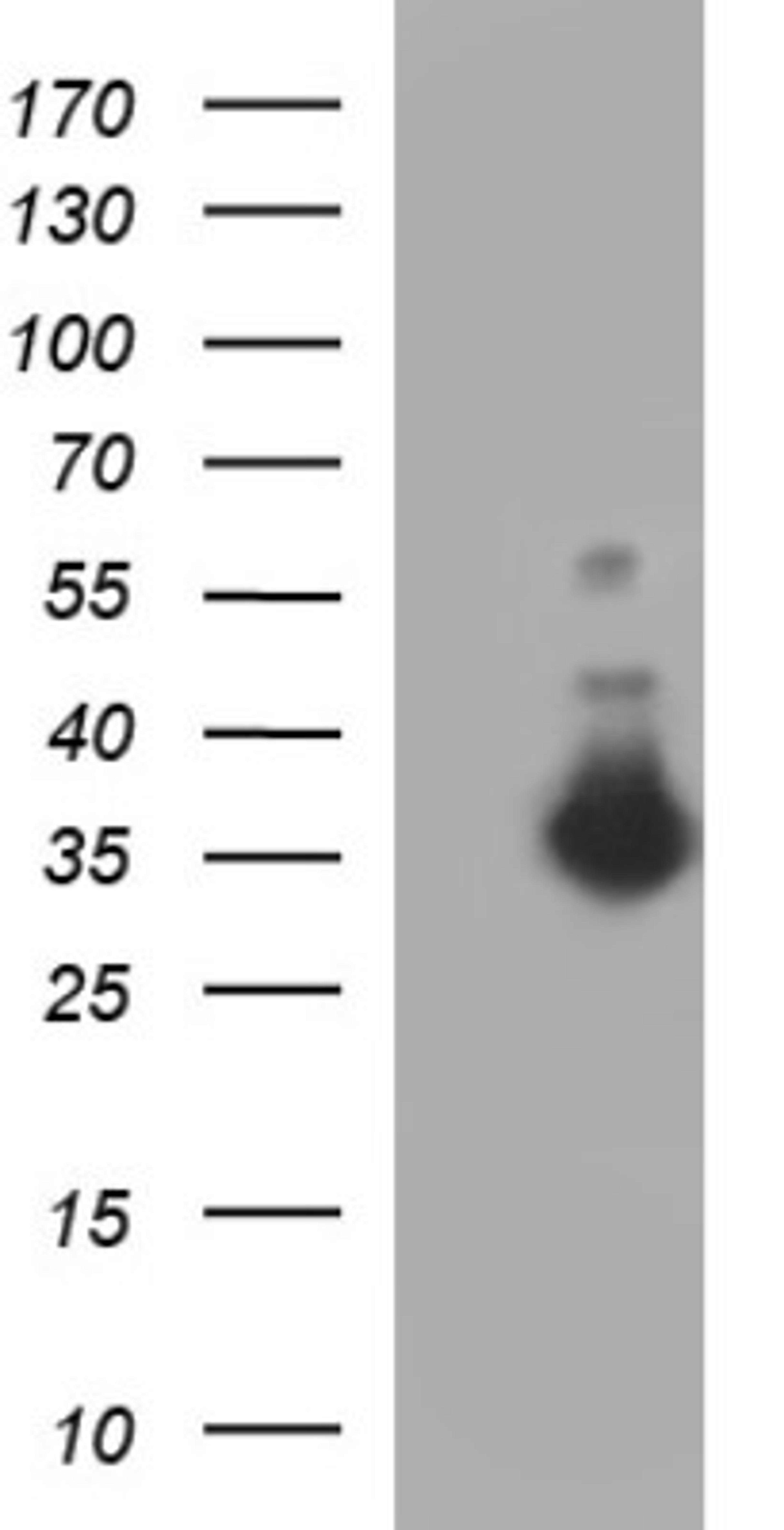 Western Blot: FNDC8 Antibody (1C10) [NBP2-45692] - Analysis of HEK293T cells were transfected with the pCMV6-ENTRY control (Left lane) or pCMV6-ENTRY FNDC8.