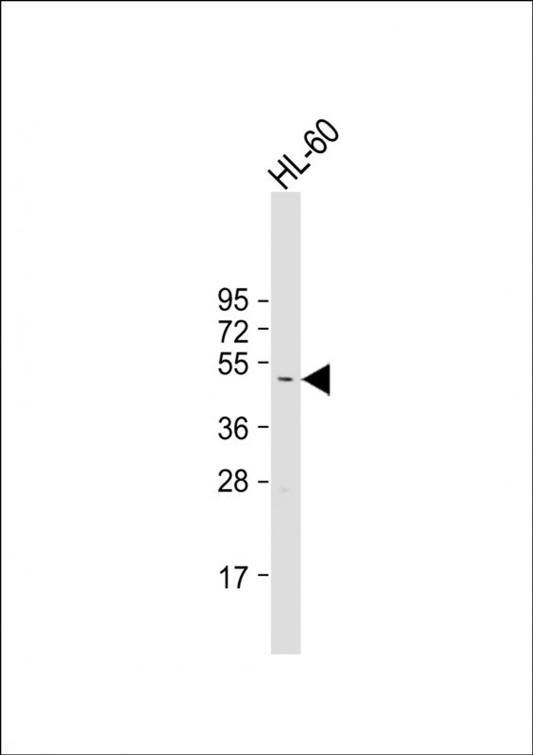 Western Blot at 1:1000 dilution + HL-60 whole cell lysate Lysates/proteins at 20 ug per lane.