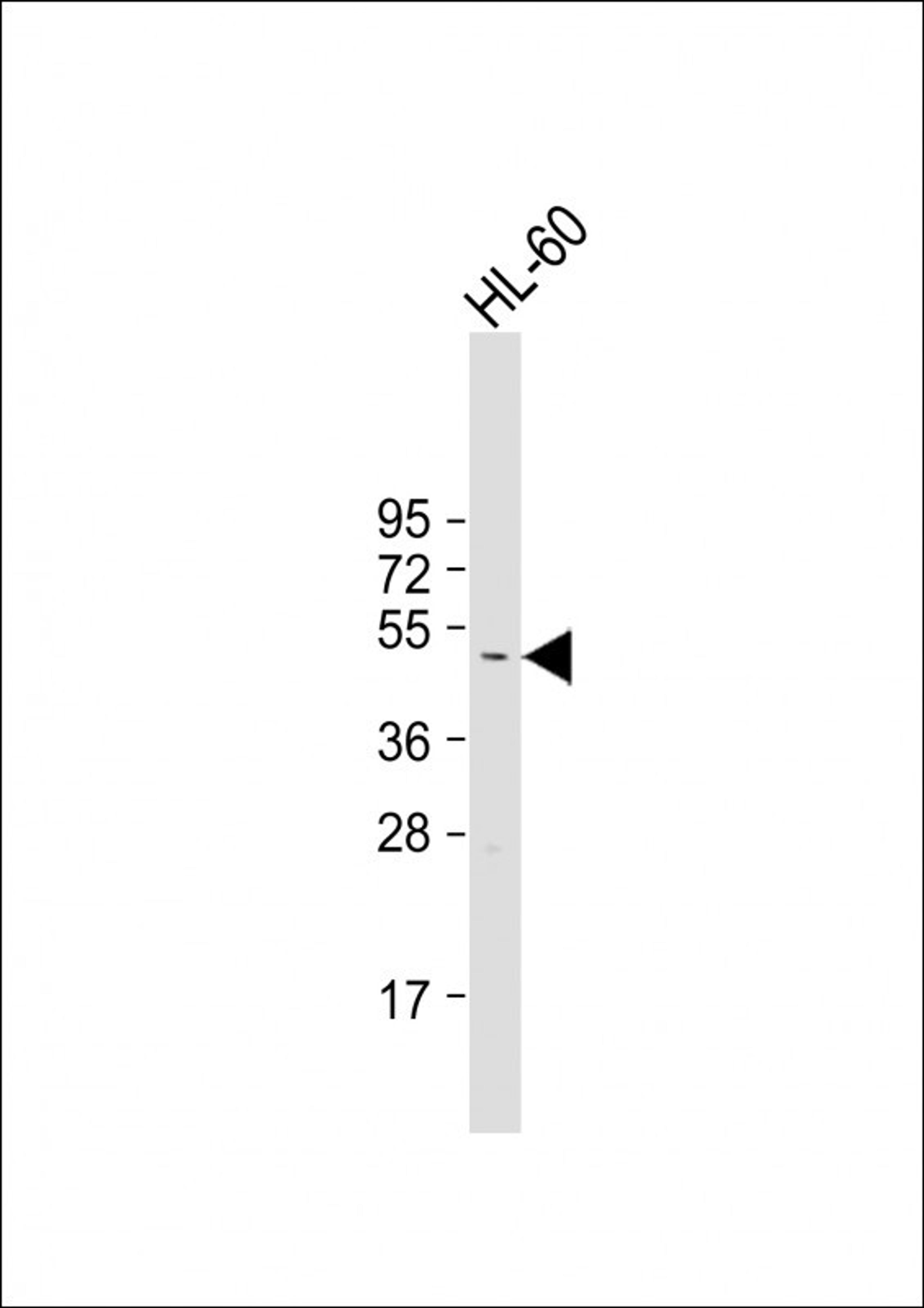 Western Blot at 1:1000 dilution + HL-60 whole cell lysate Lysates/proteins at 20 ug per lane.