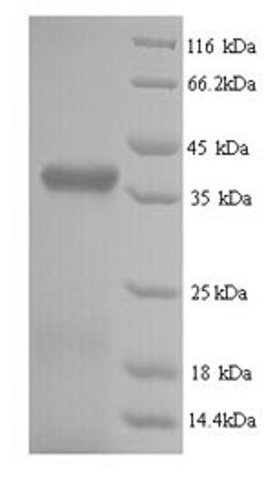 (Tris-Glycine gel) Discontinuous SDS-PAGE (reduced) with 5% enrichment gel and 15% separation gel.