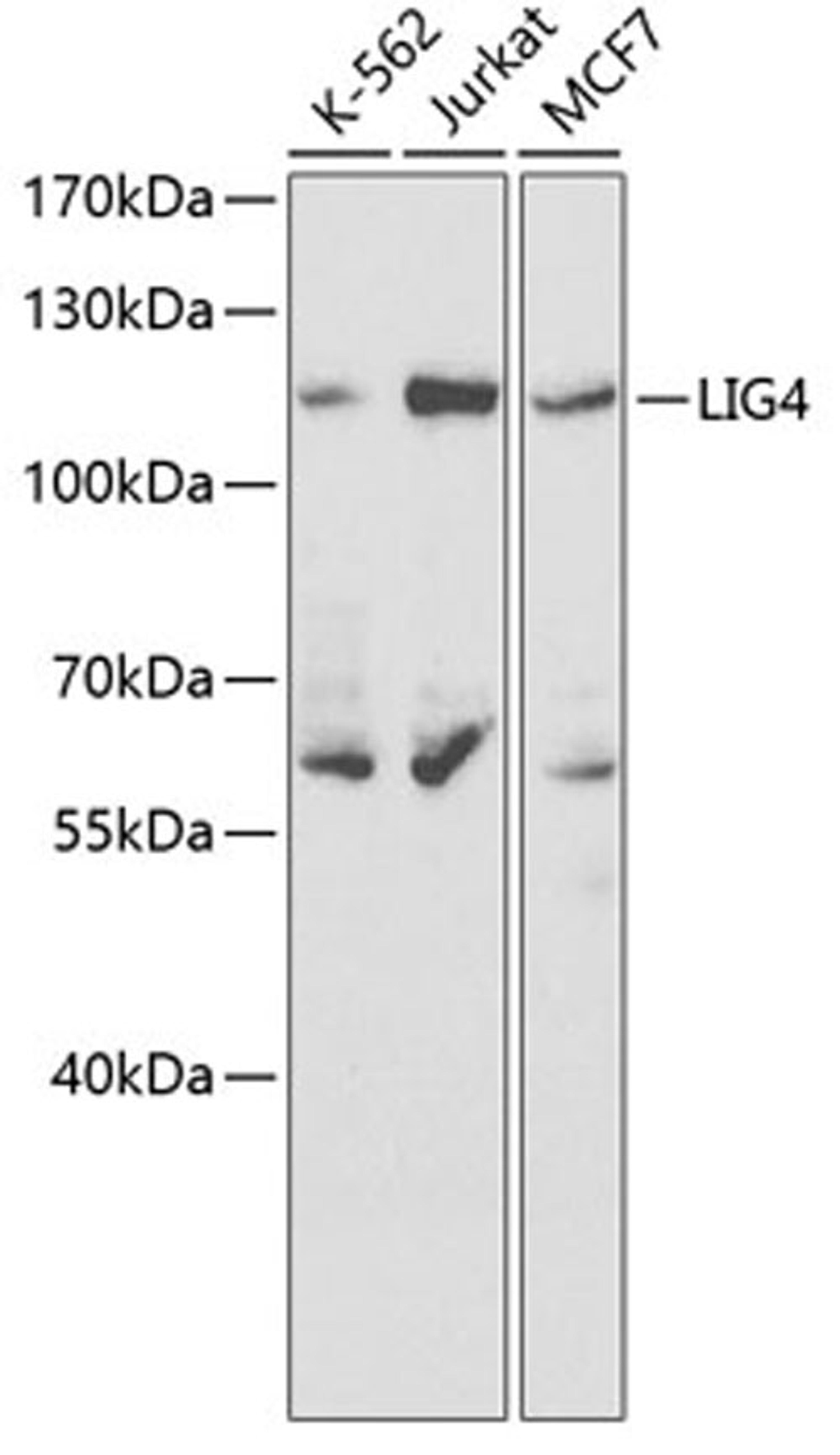 Western blot - LIG4 antibody (A1743)