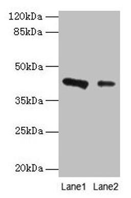 Western blot. All lanes: RAD23B antibody at 2µg/ml. Lane 1: 293T whole cell lysate. Lane 2: MCF-7 whole cell lysate. Secondary. Goat polyclonal to rabbit IgG at 1/10000 dilution. Predicted band size: 44, 36 kDa. Observed band size: 44 kDa