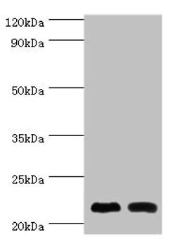 Western blot. All lanes: Neuronal calcium sensor 1 antibody at 10ug/ml. Lane 1: Hela whole cell lysate. Lane 2: Rat kidney tissue. Secondary. Goat polyclonal to rabbit IgG at 1/10000 dilution. Predicted band size: 22, 20 kDa. Observed band size: 22 kDa.